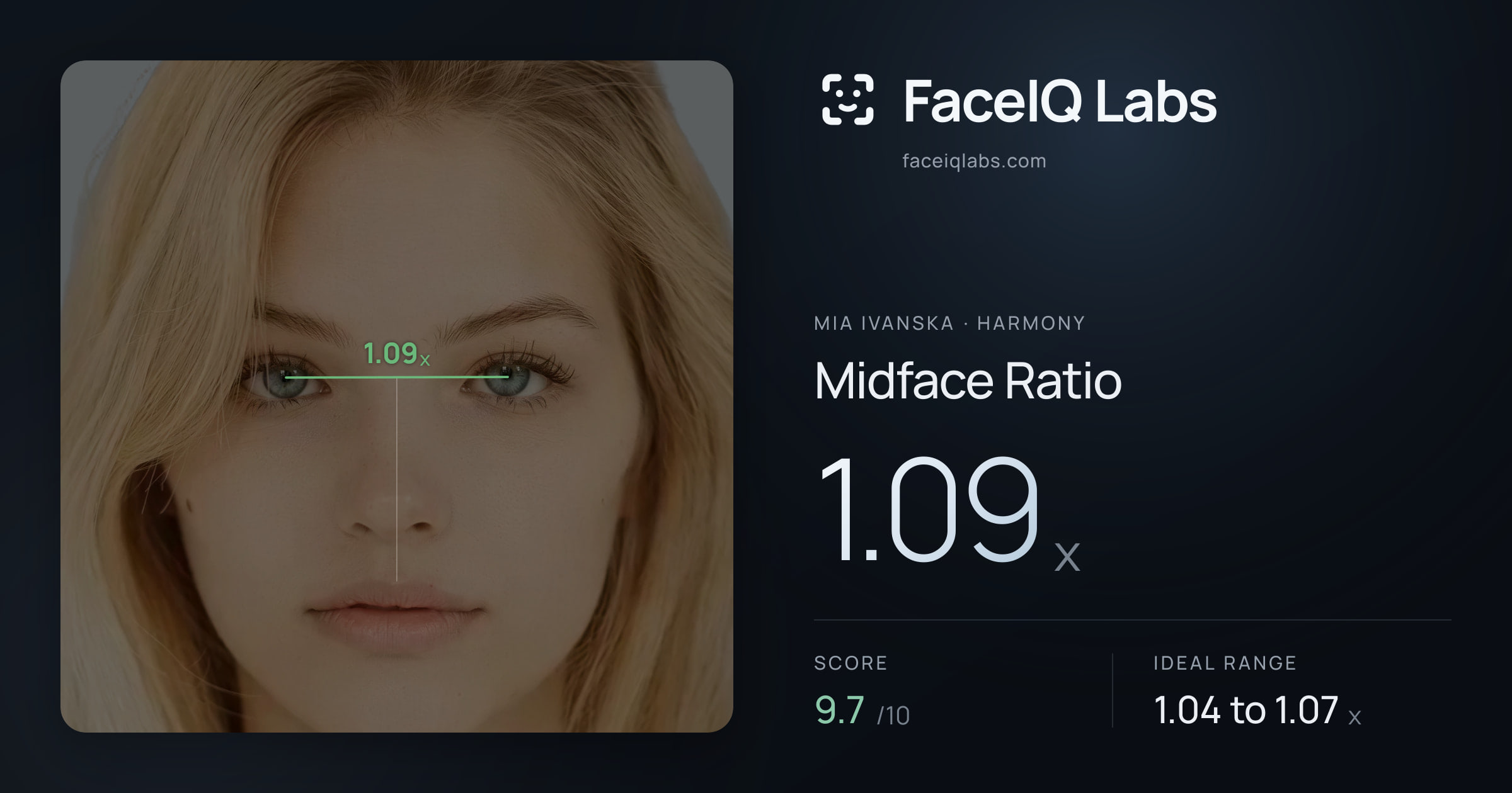 Mia Ivanska Midface Ratio: 1.09x, drawn on the photo