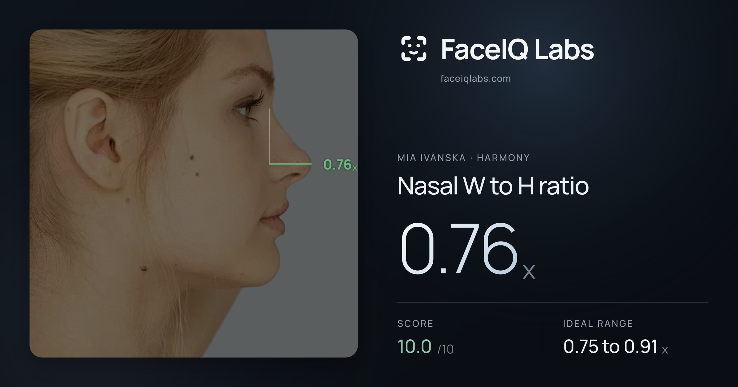 Mia Ivanska Nasal W to H ratio: 0.76x, drawn on the photo