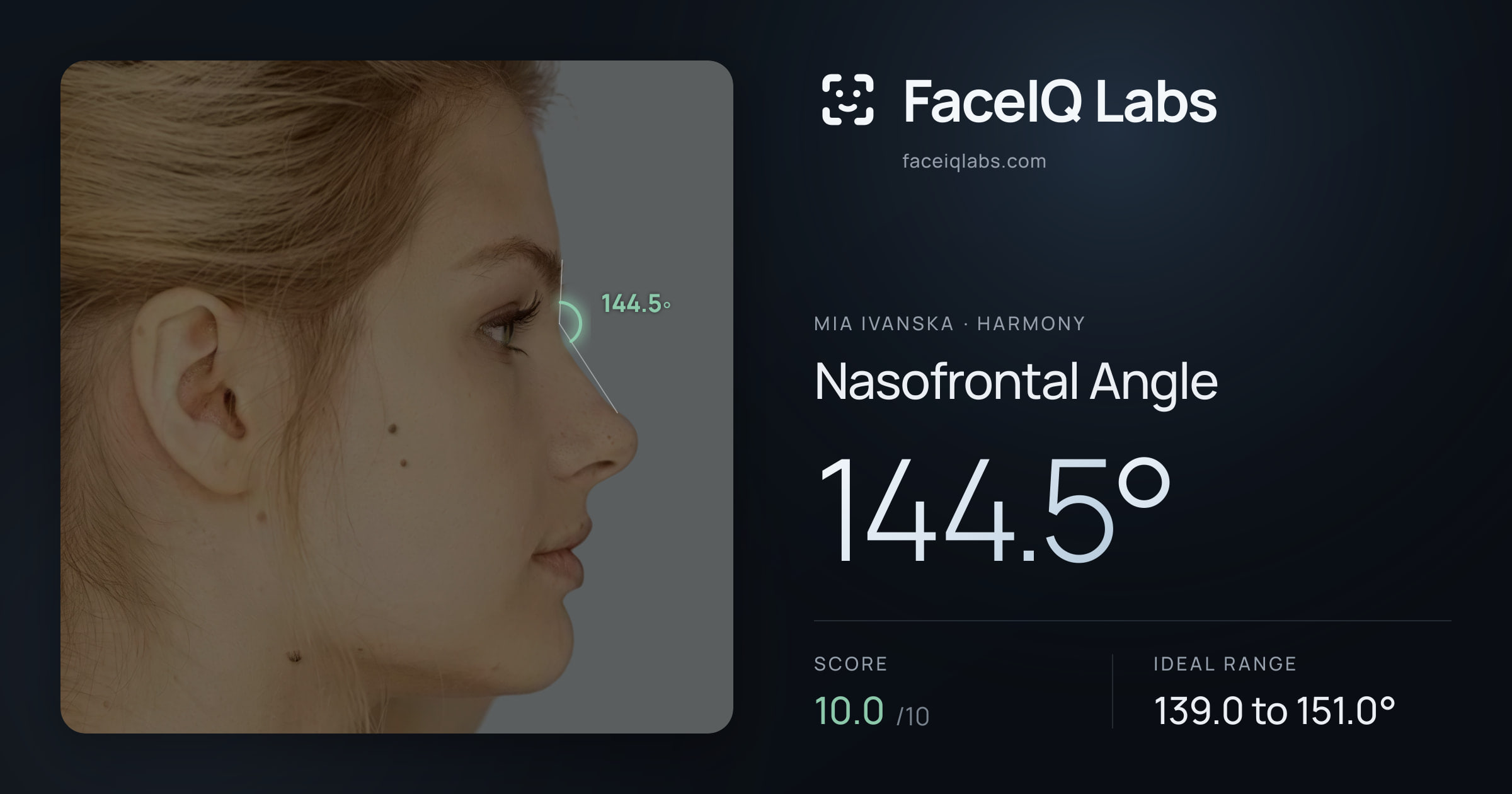 Mia Ivanska Nasofrontal Angle: 144.5°, drawn on the photo