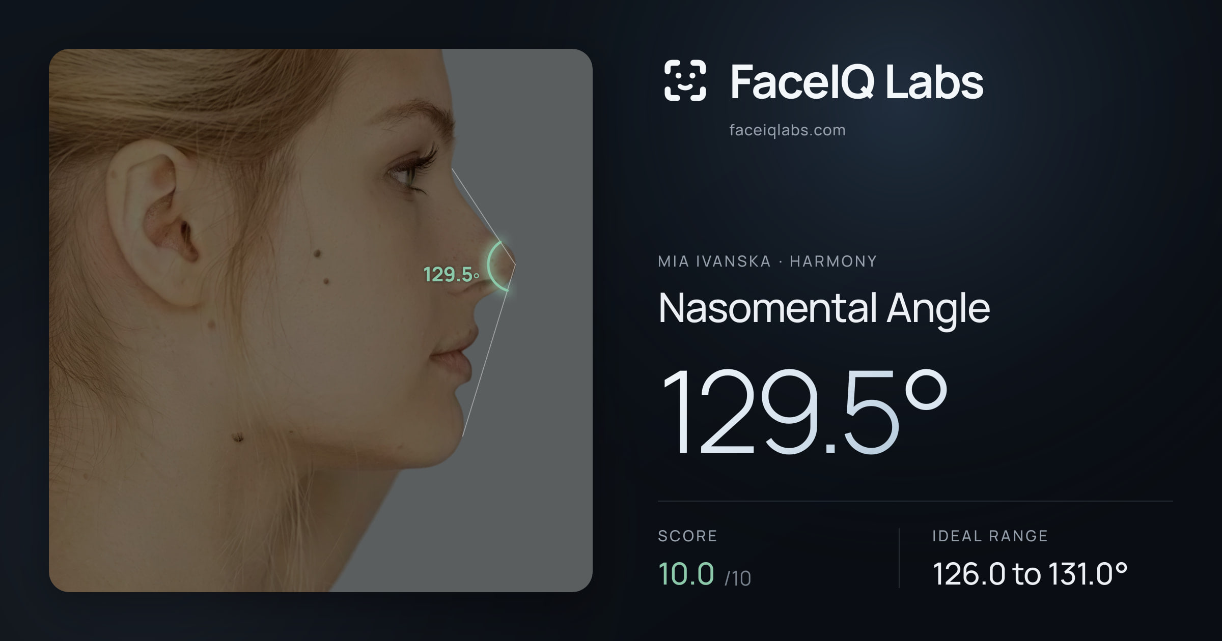 Mia Ivanska Nasomental Angle: 129.5°, drawn on the photo