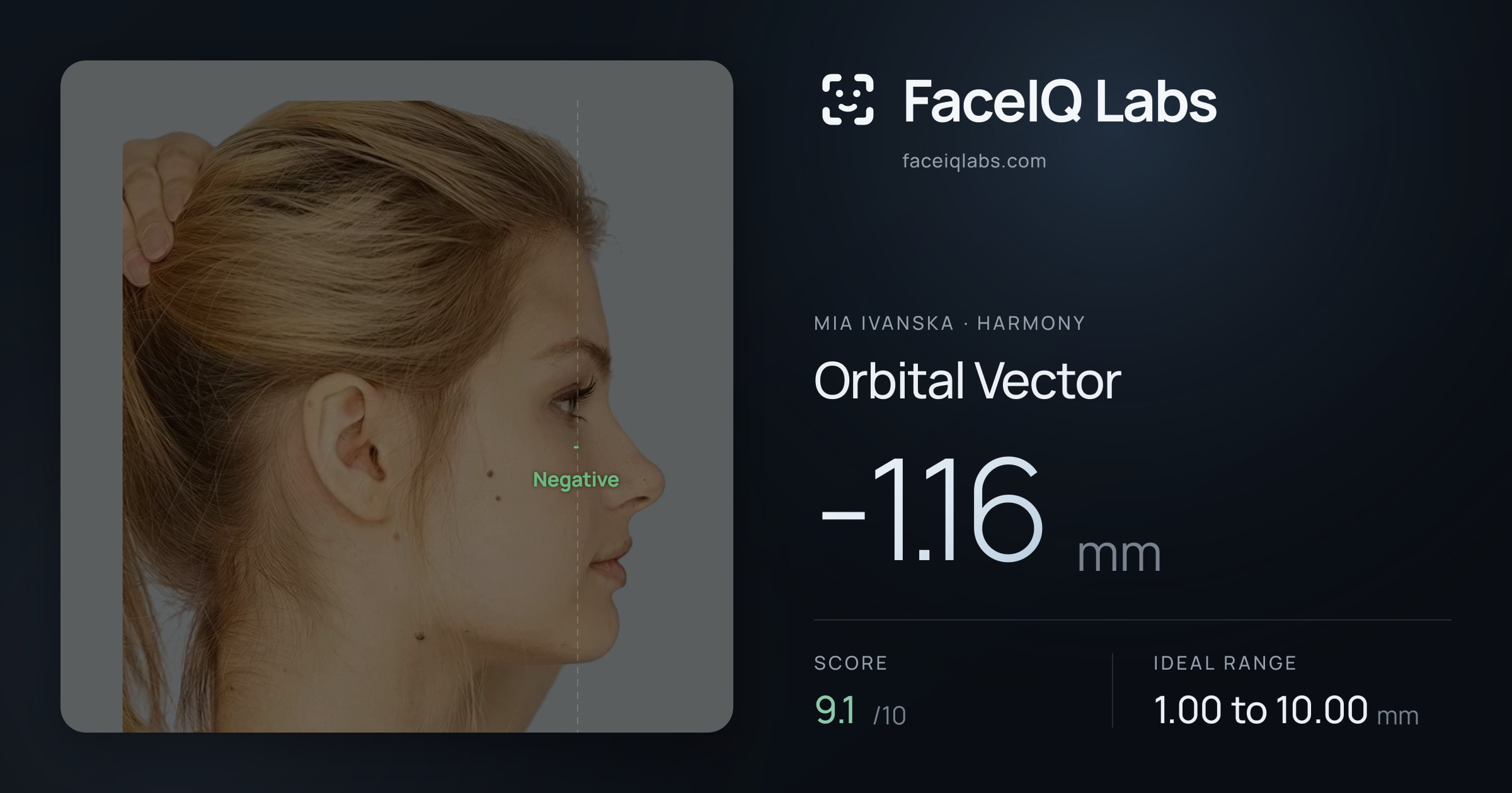 Mia Ivanska Orbital Vector: -1.16mm, drawn on the photo