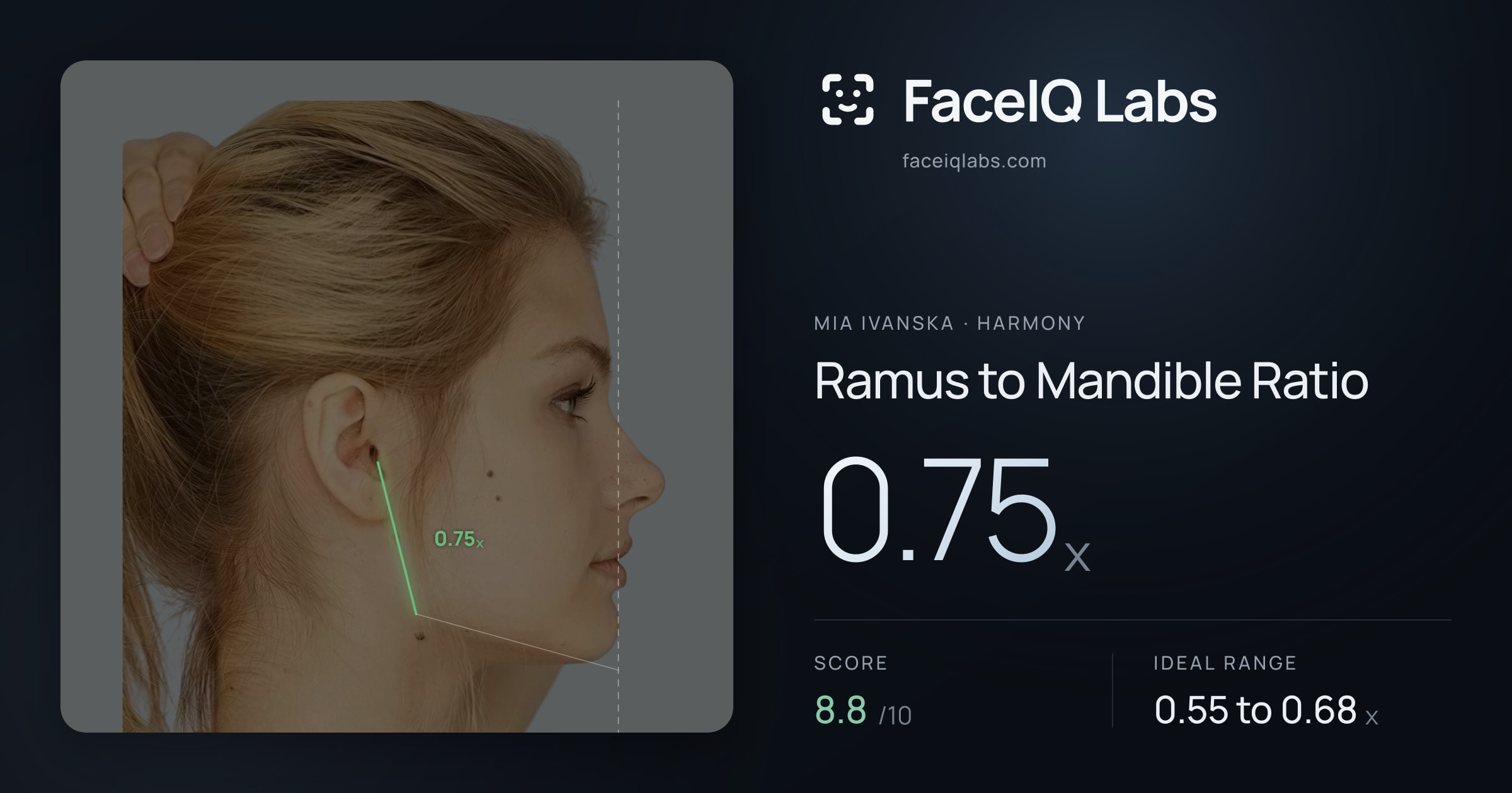 Mia Ivanska Ramus to Mandible Ratio: 0.75x, drawn on the photo