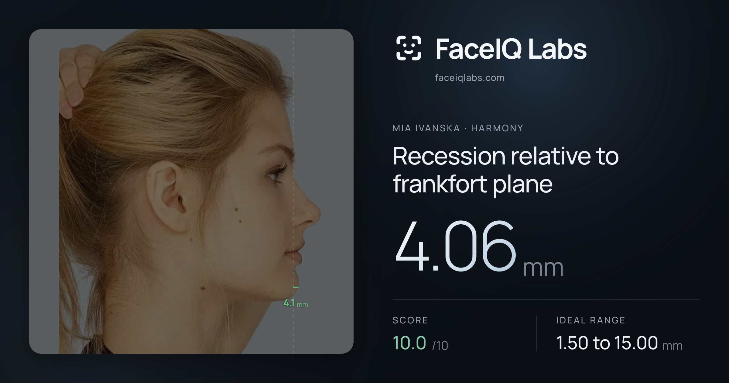 Mia Ivanska Recession relative to frankfort plane: 4.06mm, drawn on the photo