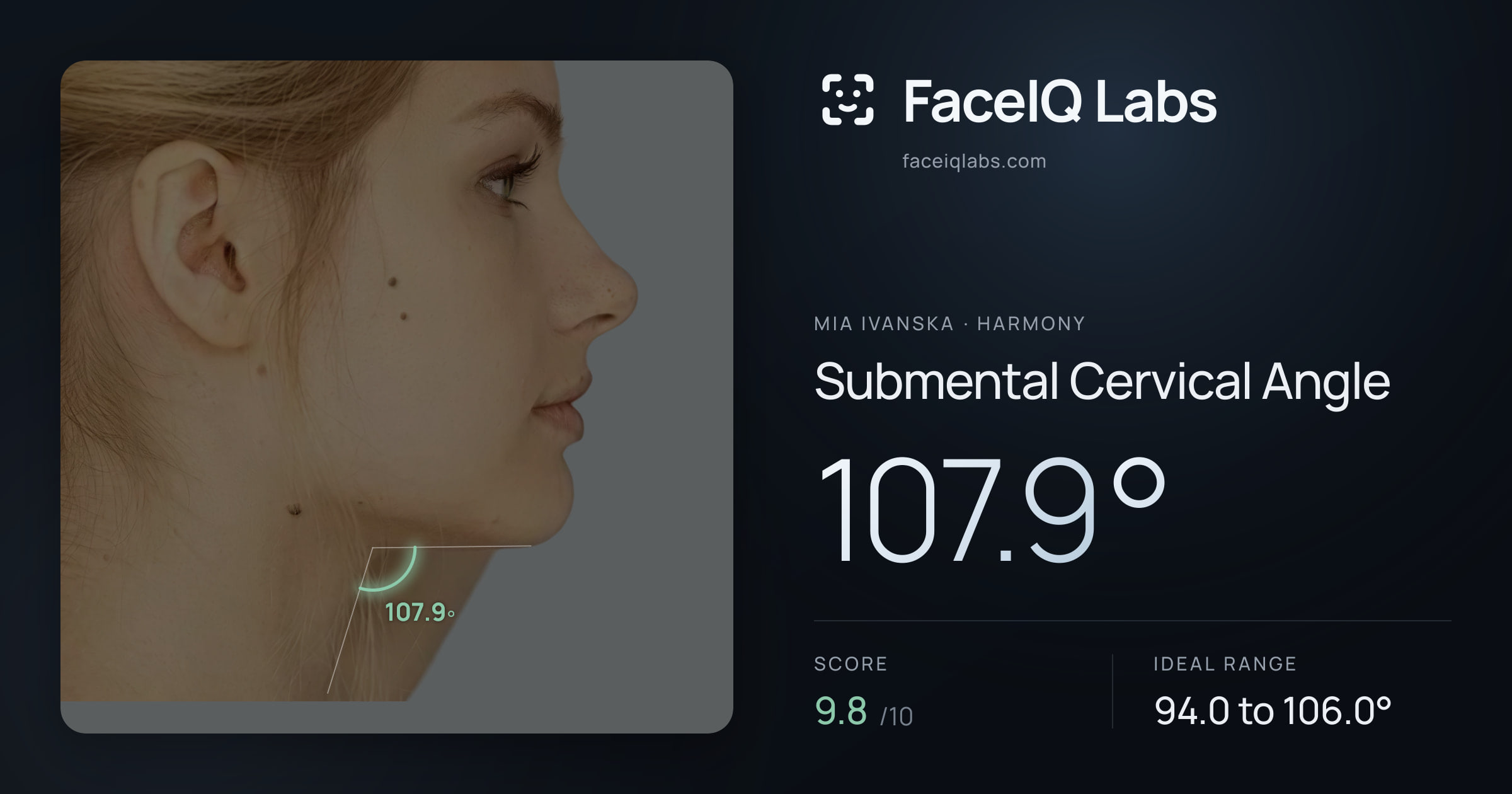 Mia Ivanska Submental Cervical Angle: 107.9°, drawn on the photo