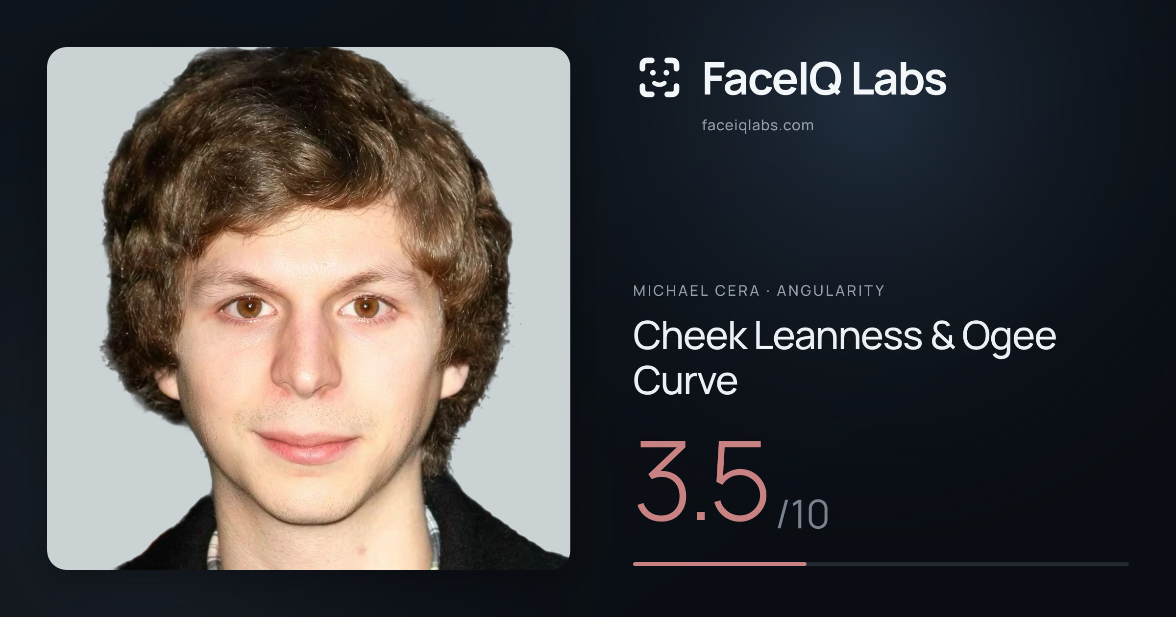 Michael Cera Cheek Leanness & Ogee Curve: 3.5/10, drawn on the photo