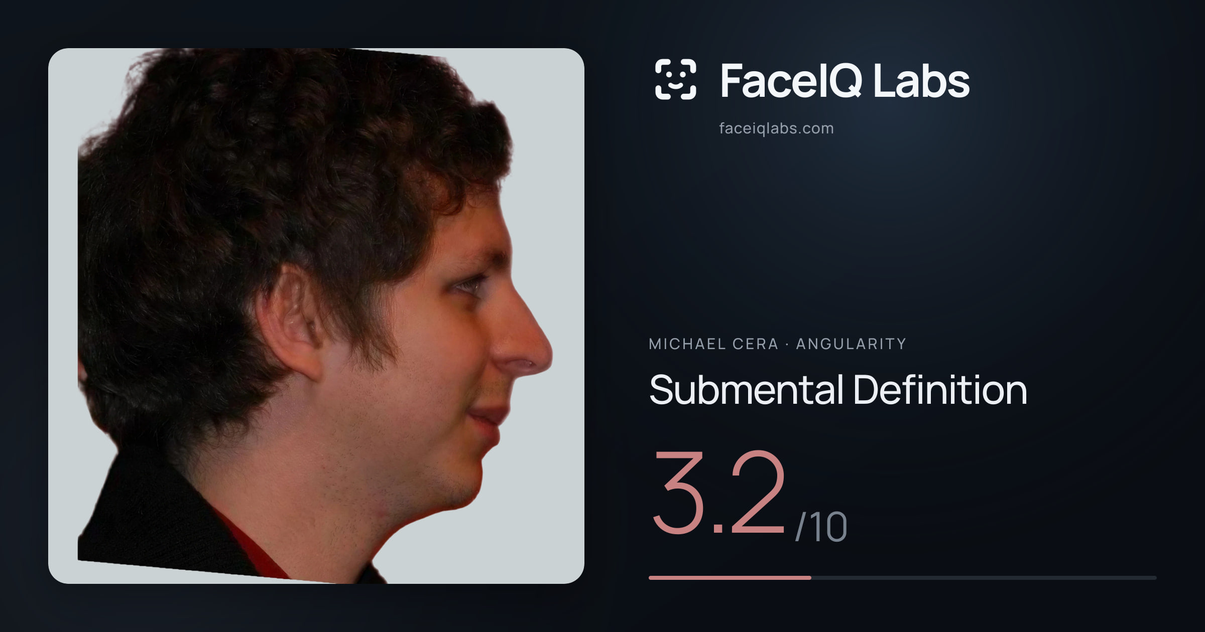 Michael Cera Submental Definition: 3.2/10, drawn on the photo