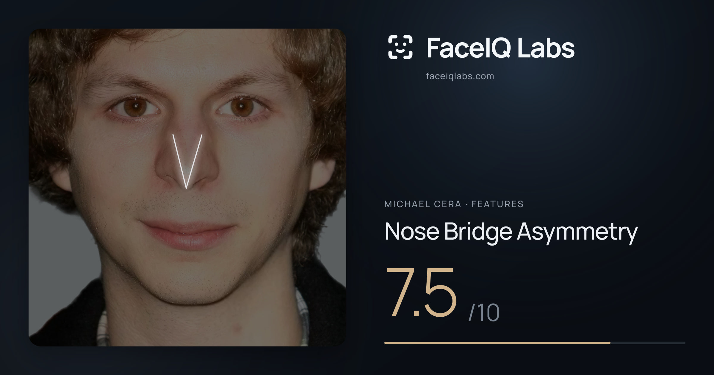 Michael Cera Nose Bridge Asymmetry: 7.5/10, drawn on the photo