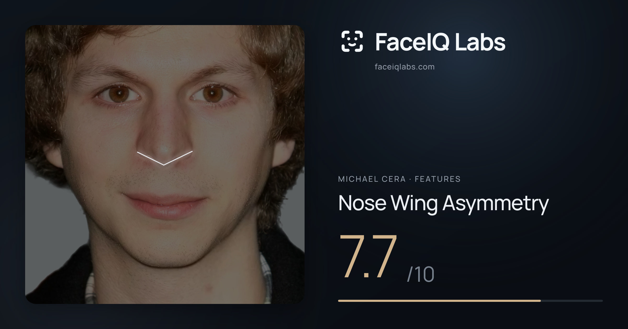 Michael Cera Nose Wing Asymmetry: 7.7/10, drawn on the photo