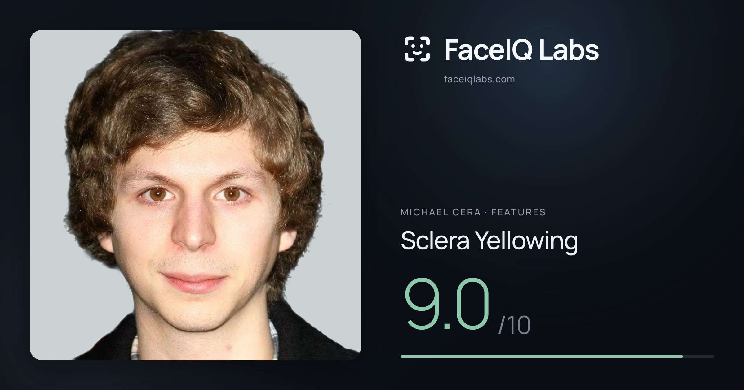 Michael Cera Sclera Yellowing: 9.0/10, drawn on the photo