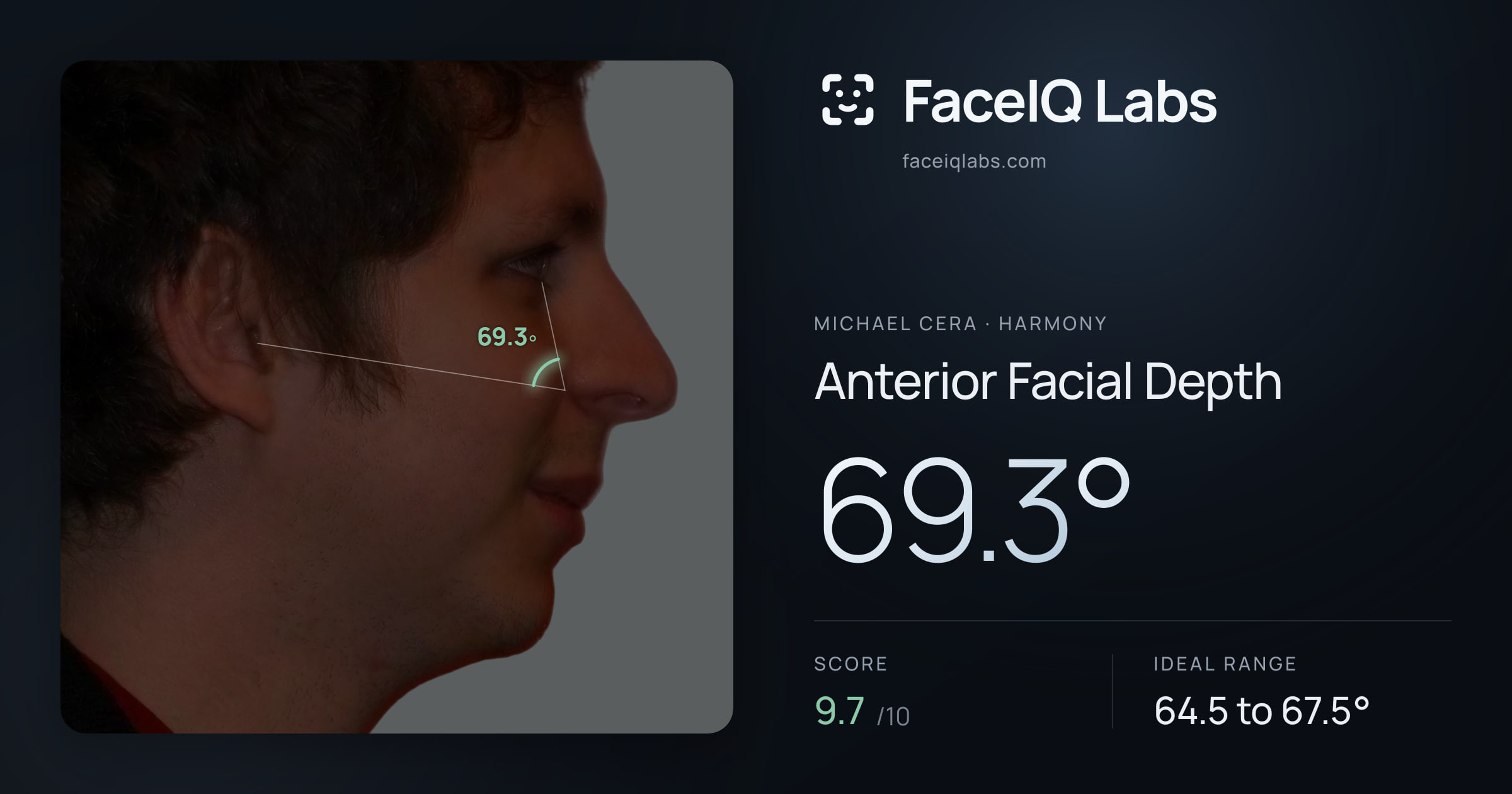 Michael Cera Anterior Facial Depth: 69.3°, drawn on the photo