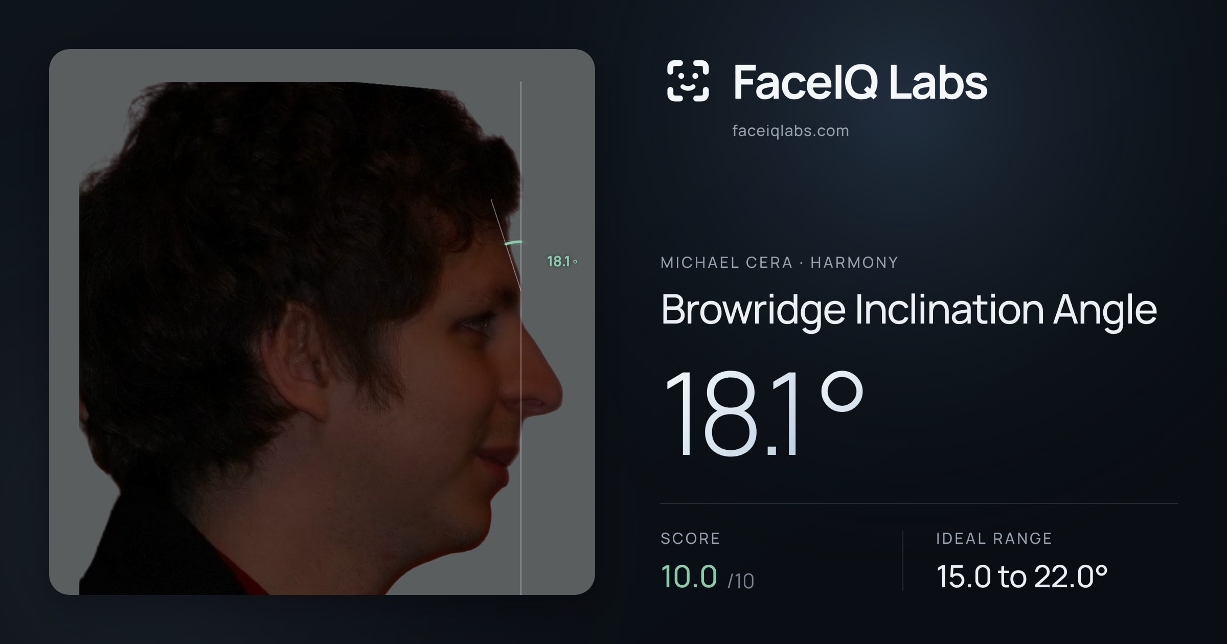 Michael Cera Browridge Inclination Angle: 18.1°, drawn on the photo