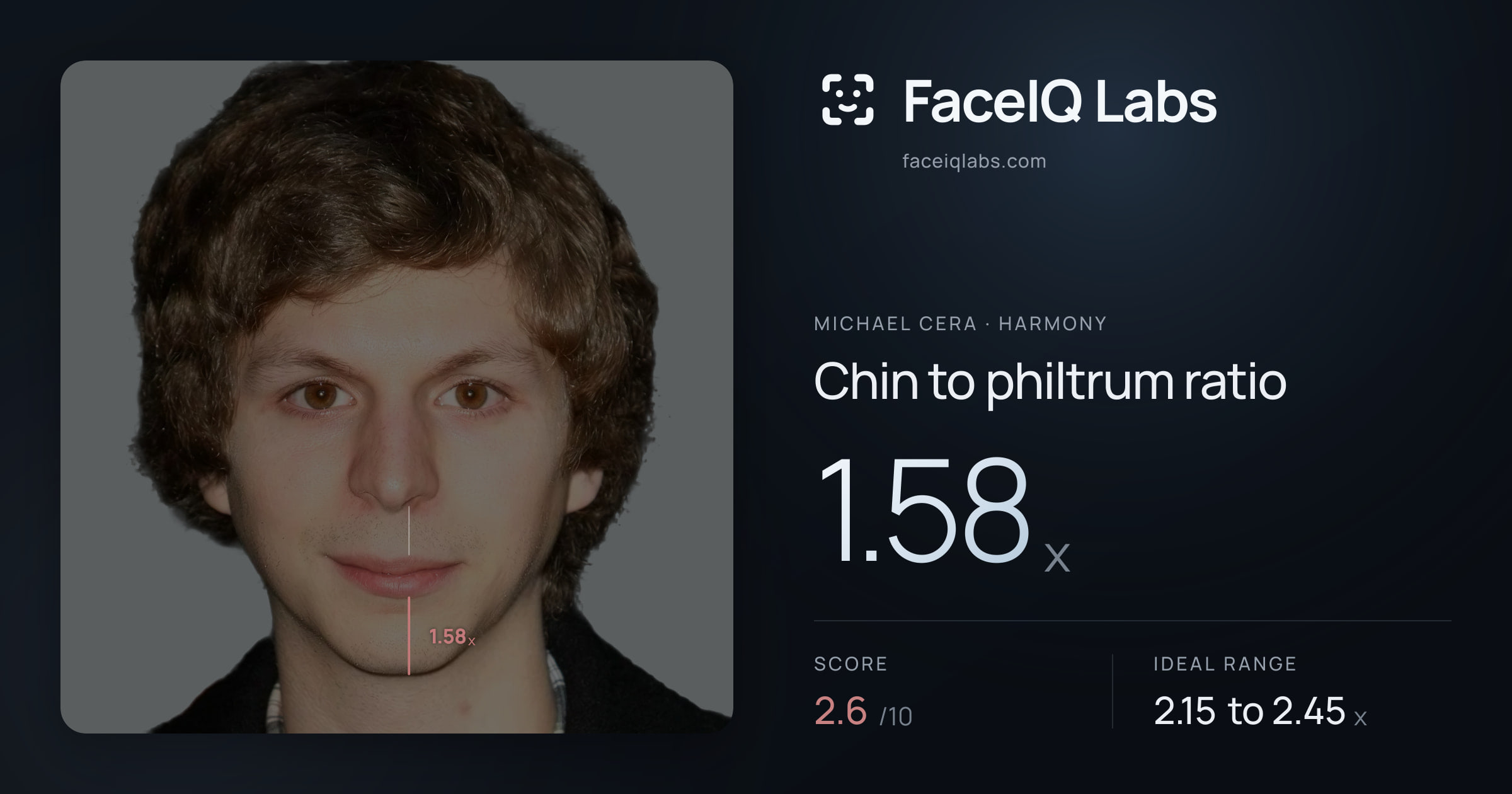 Michael Cera Chin to philtrum ratio: 1.58x, drawn on the photo