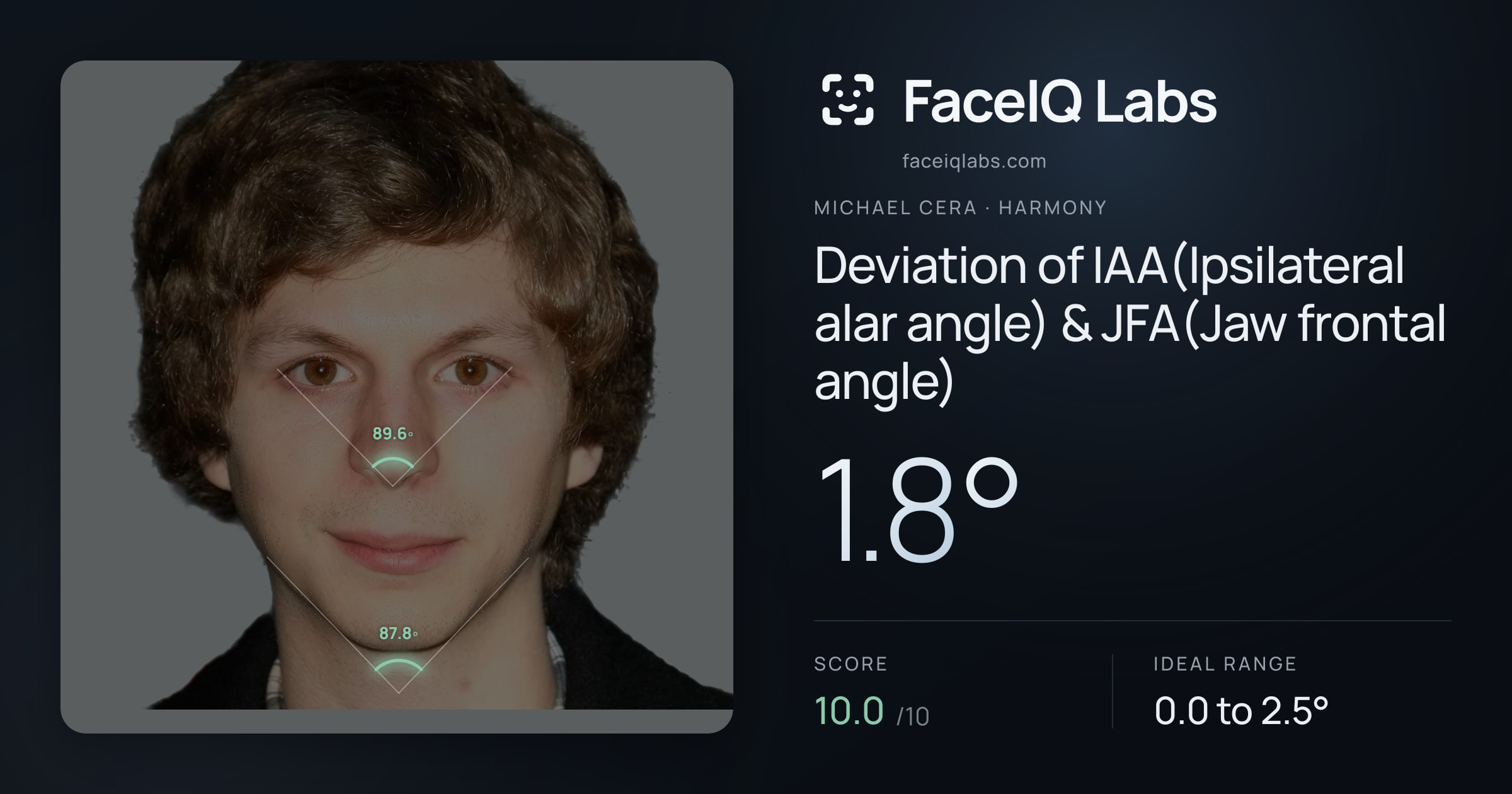 Michael Cera Deviation of IAA(Ipsilateral alar angle) & JFA(Jaw frontal angle): 1.8°, drawn on the photo