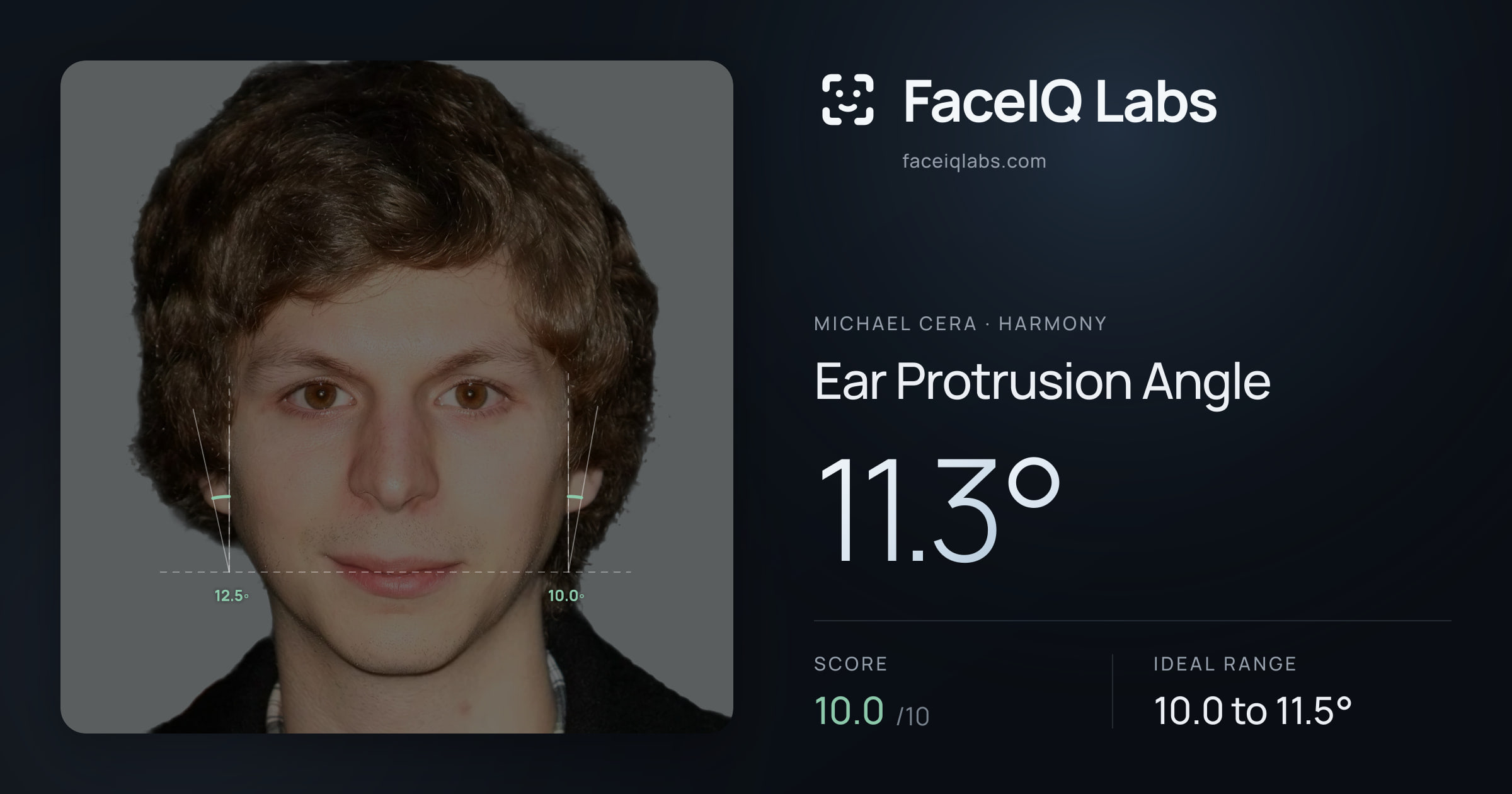 Michael Cera Ear Protrusion Angle: 11.3°, drawn on the photo