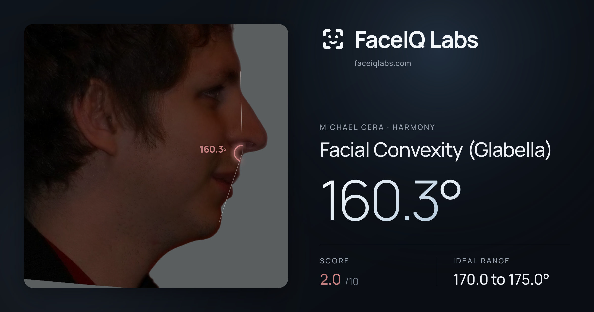 Michael Cera Facial Convexity (Glabella): 160.3°, drawn on the photo