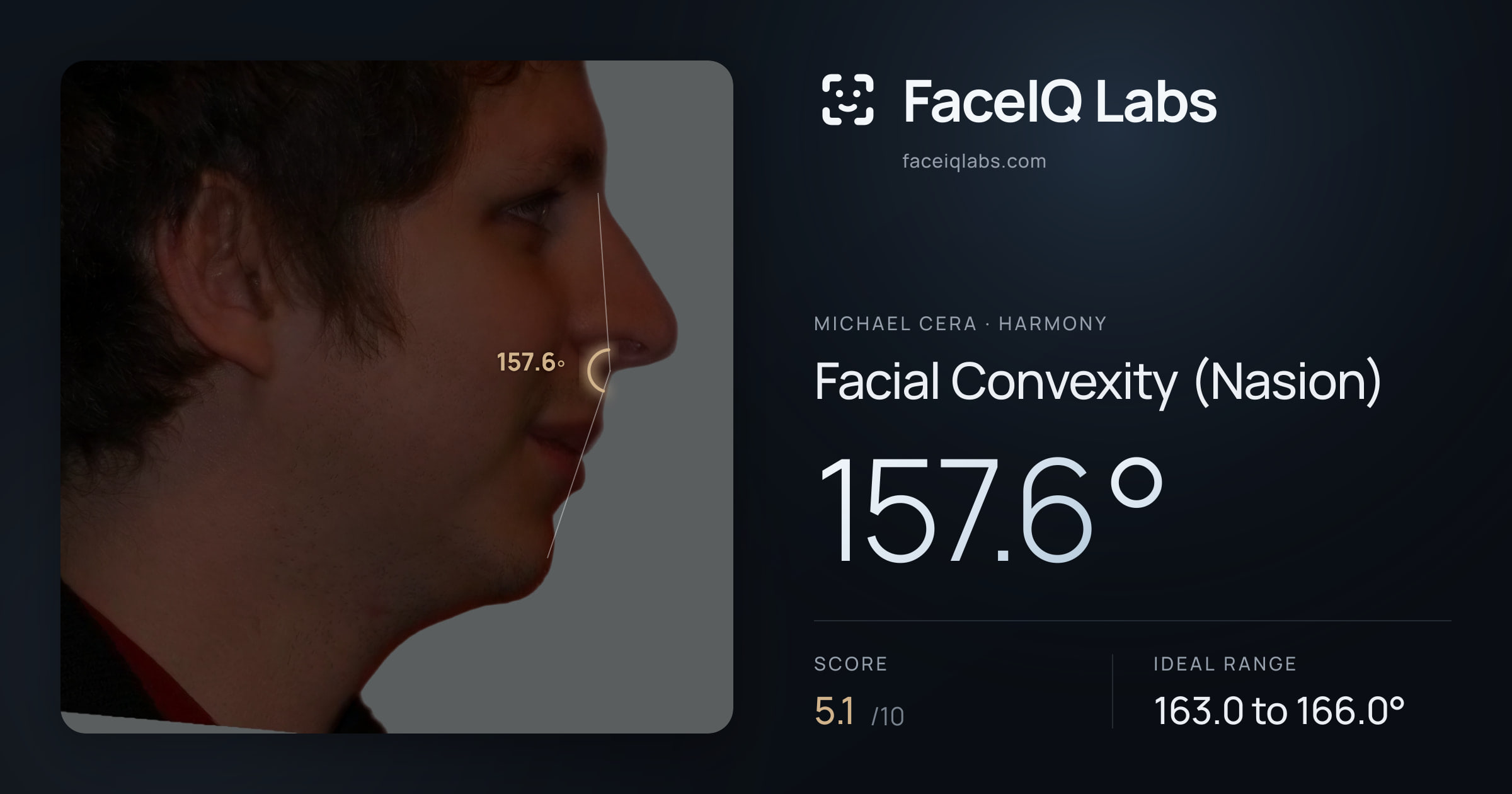 Michael Cera Facial Convexity (Nasion): 157.6°, drawn on the photo