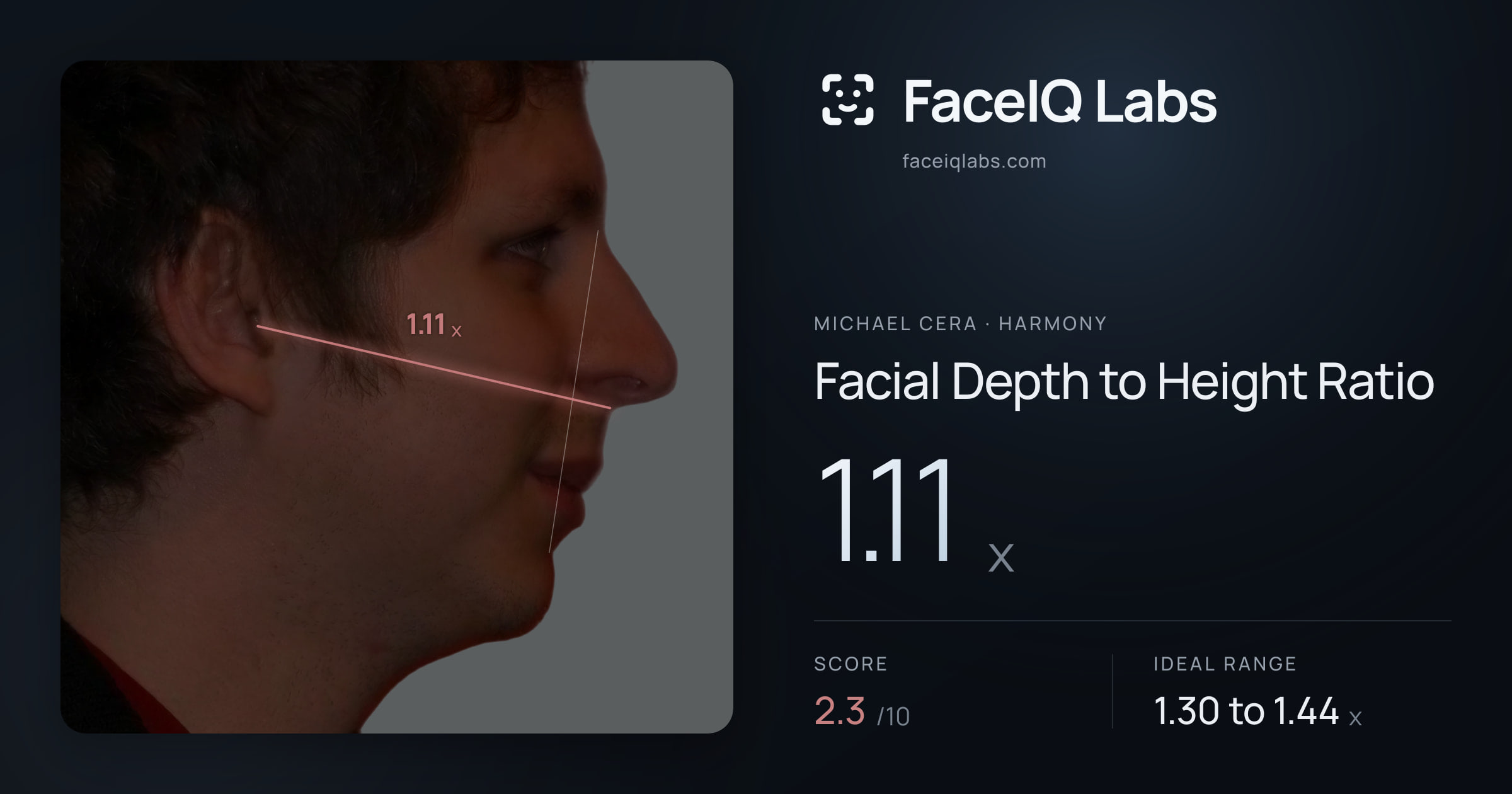 Michael Cera Facial Depth to Height Ratio: 1.11x, drawn on the photo