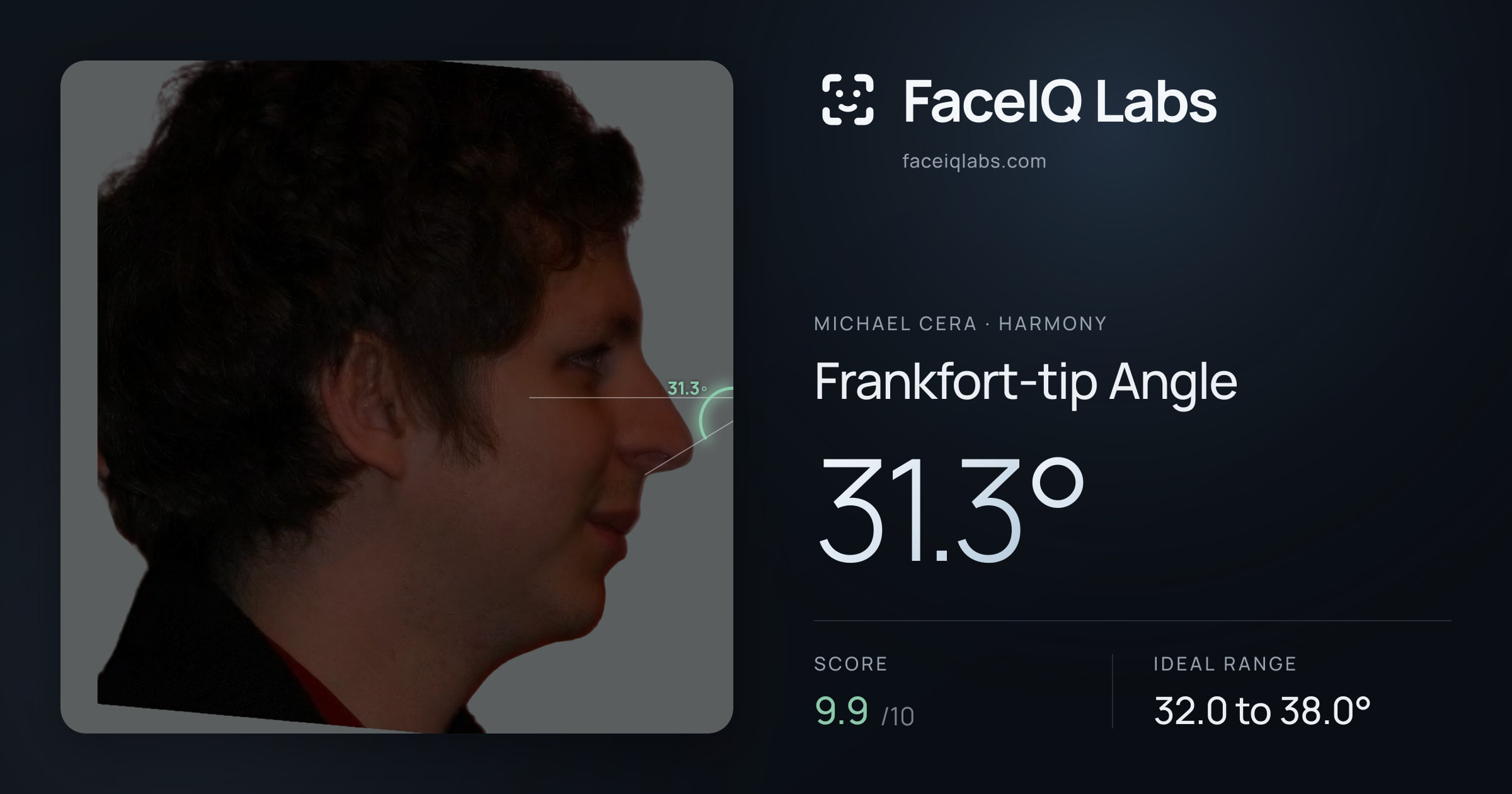Michael Cera Frankfort-tip Angle: 31.3°, drawn on the photo