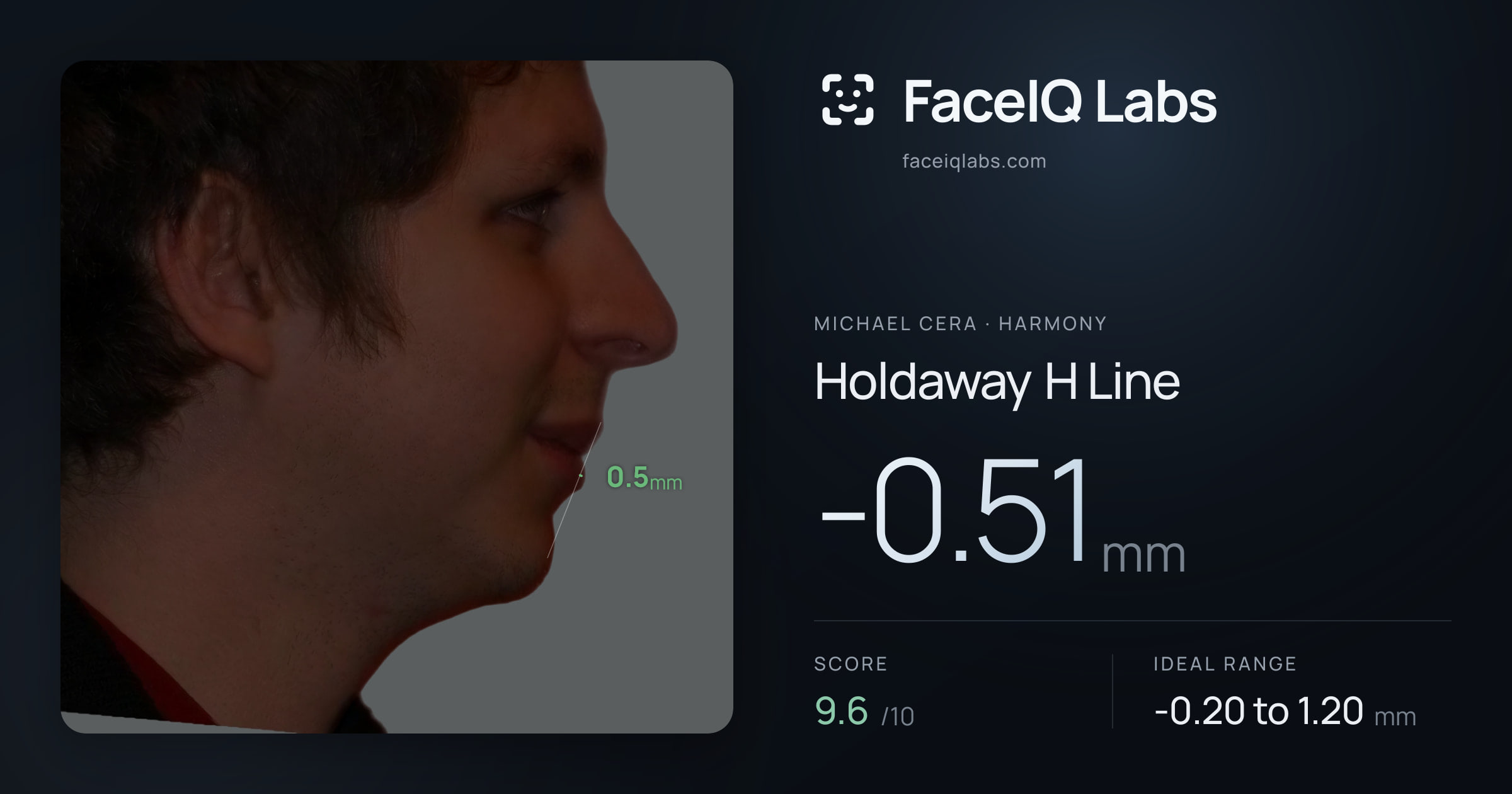 Michael Cera Holdaway H Line: -0.51mm, drawn on the photo