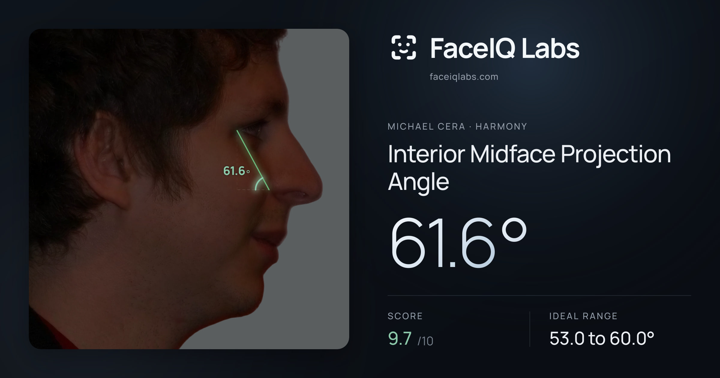 Michael Cera Interior Midface Projection Angle: 61.6°, drawn on the photo