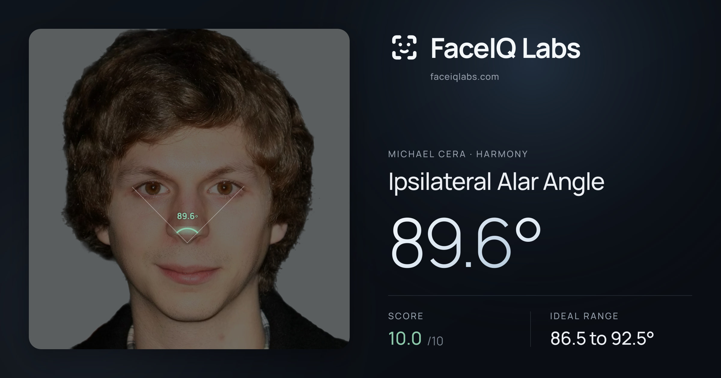 Michael Cera Ipsilateral Alar Angle: 89.6°, drawn on the photo