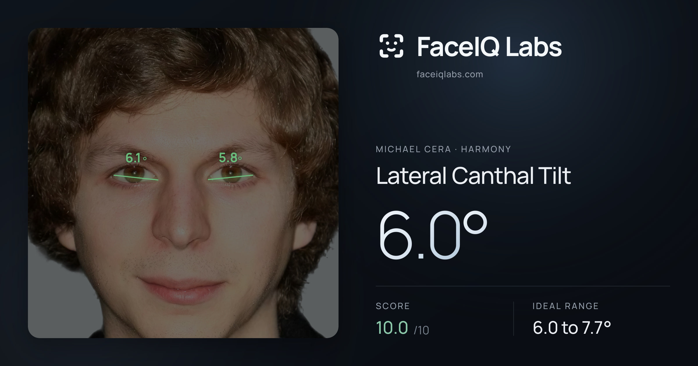 Michael Cera Lateral Canthal Tilt: 6.0°, drawn on the photo