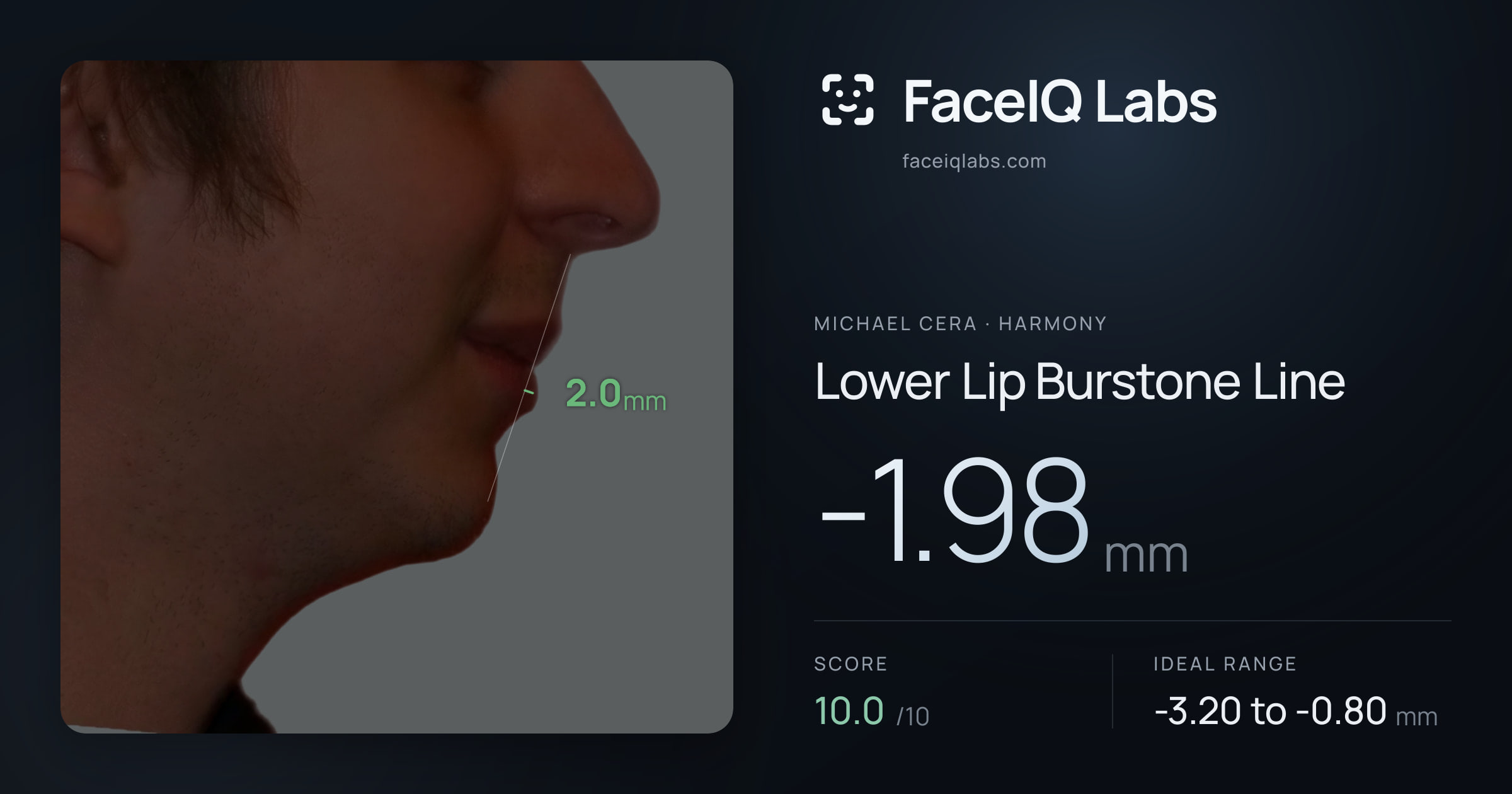 Michael Cera Lower Lip Burstone Line: -1.98mm, drawn on the photo
