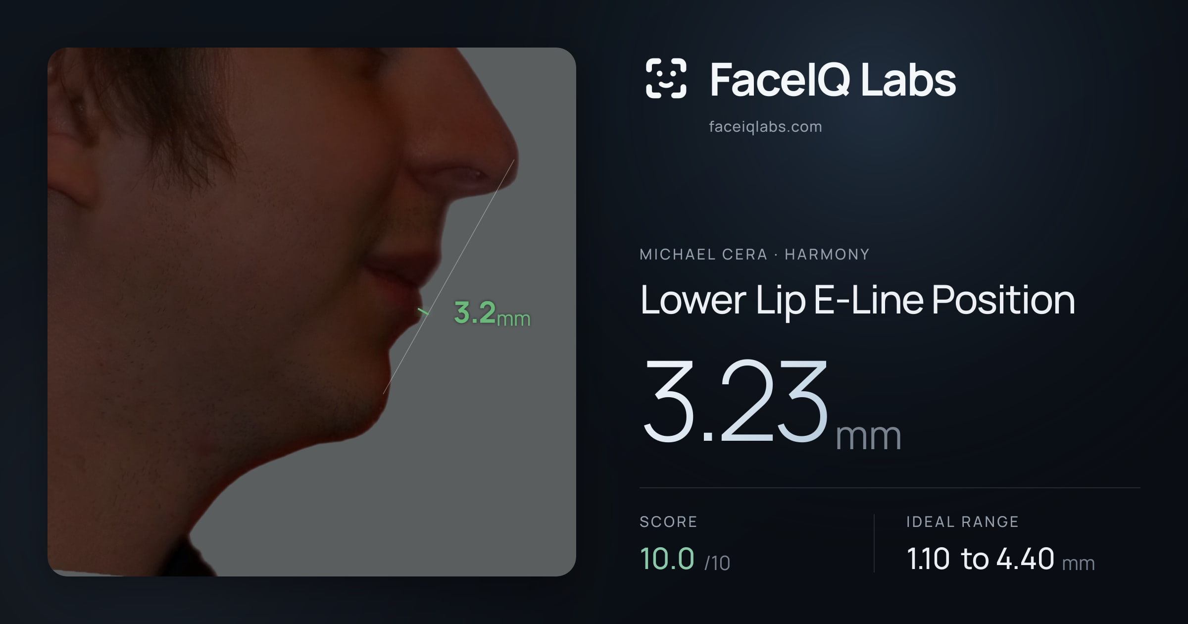 Michael Cera Lower Lip E-Line Position: 3.23mm, drawn on the photo