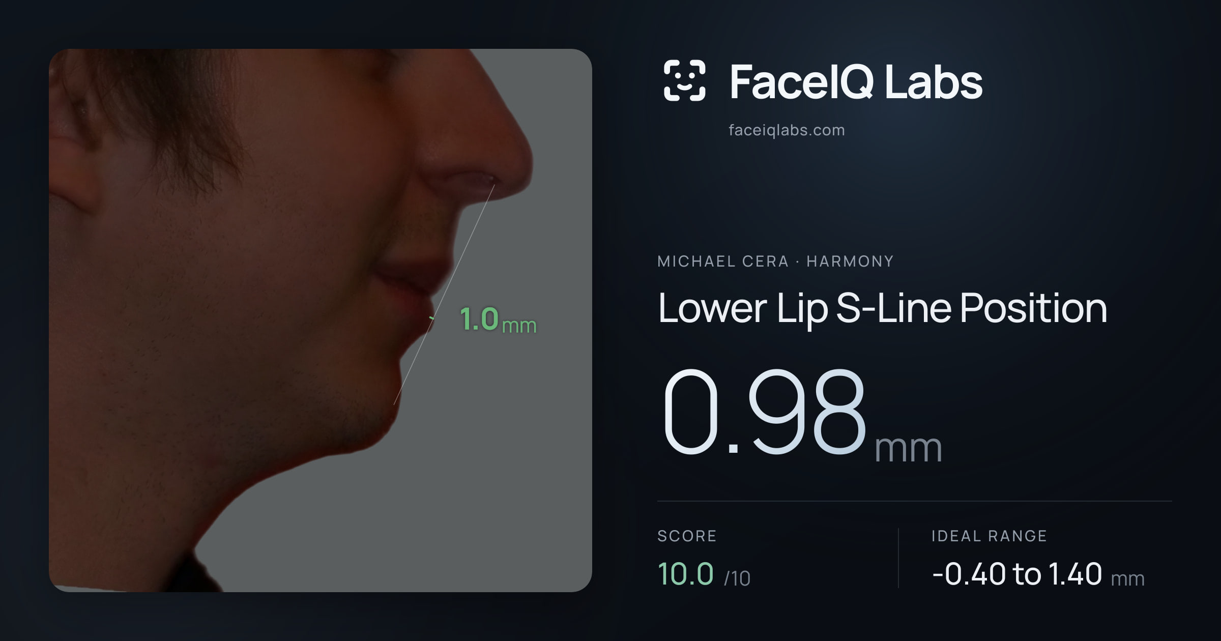 Michael Cera Lower Lip S-Line Position: 0.98mm, drawn on the photo