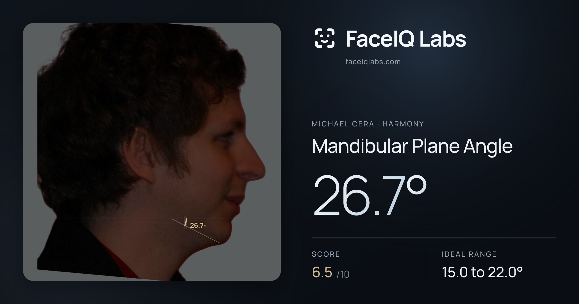Michael Cera Mandibular Plane Angle: 26.7°, drawn on the photo
