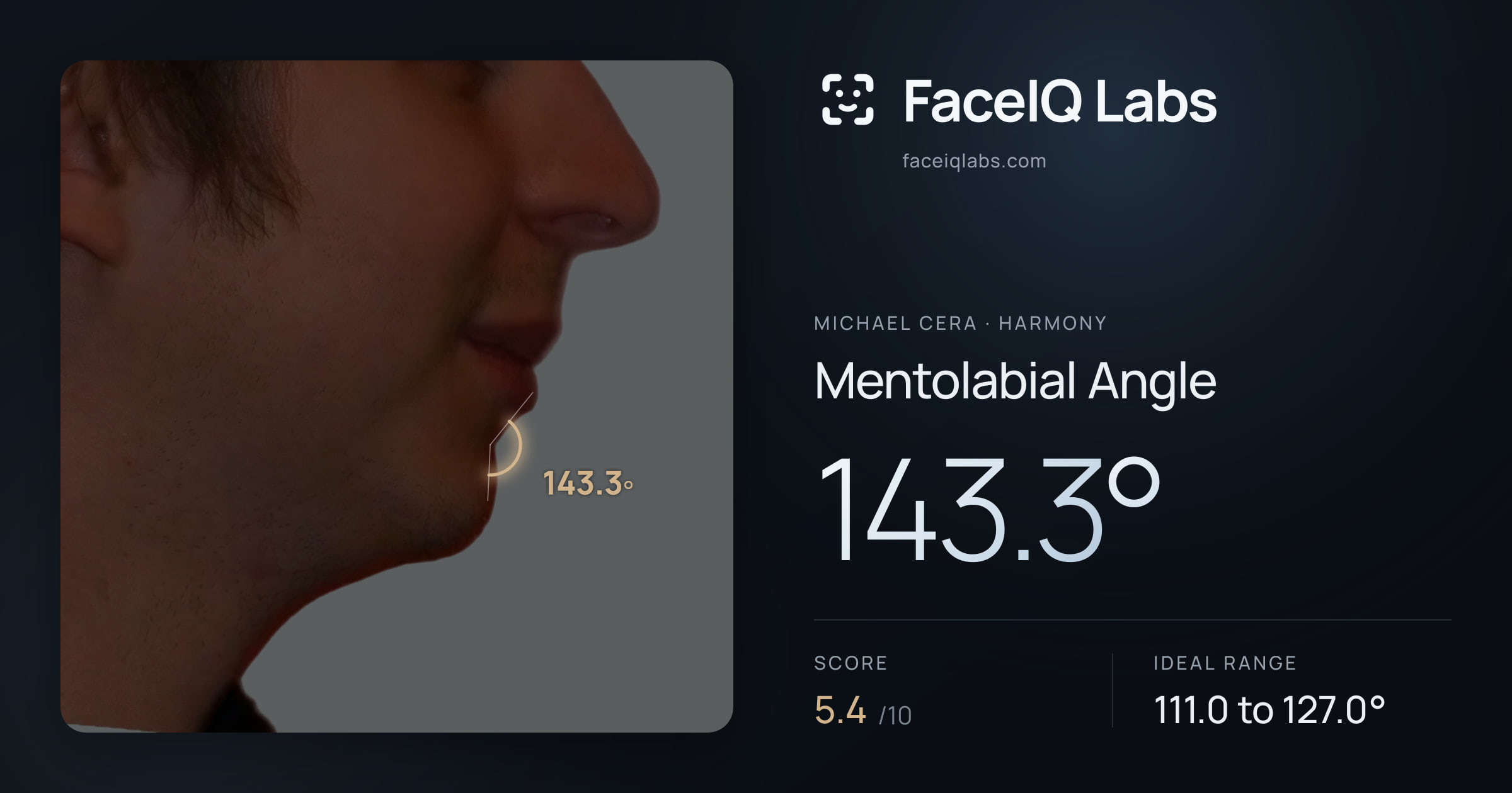 Michael Cera Mentolabial Angle: 143.3°, drawn on the photo