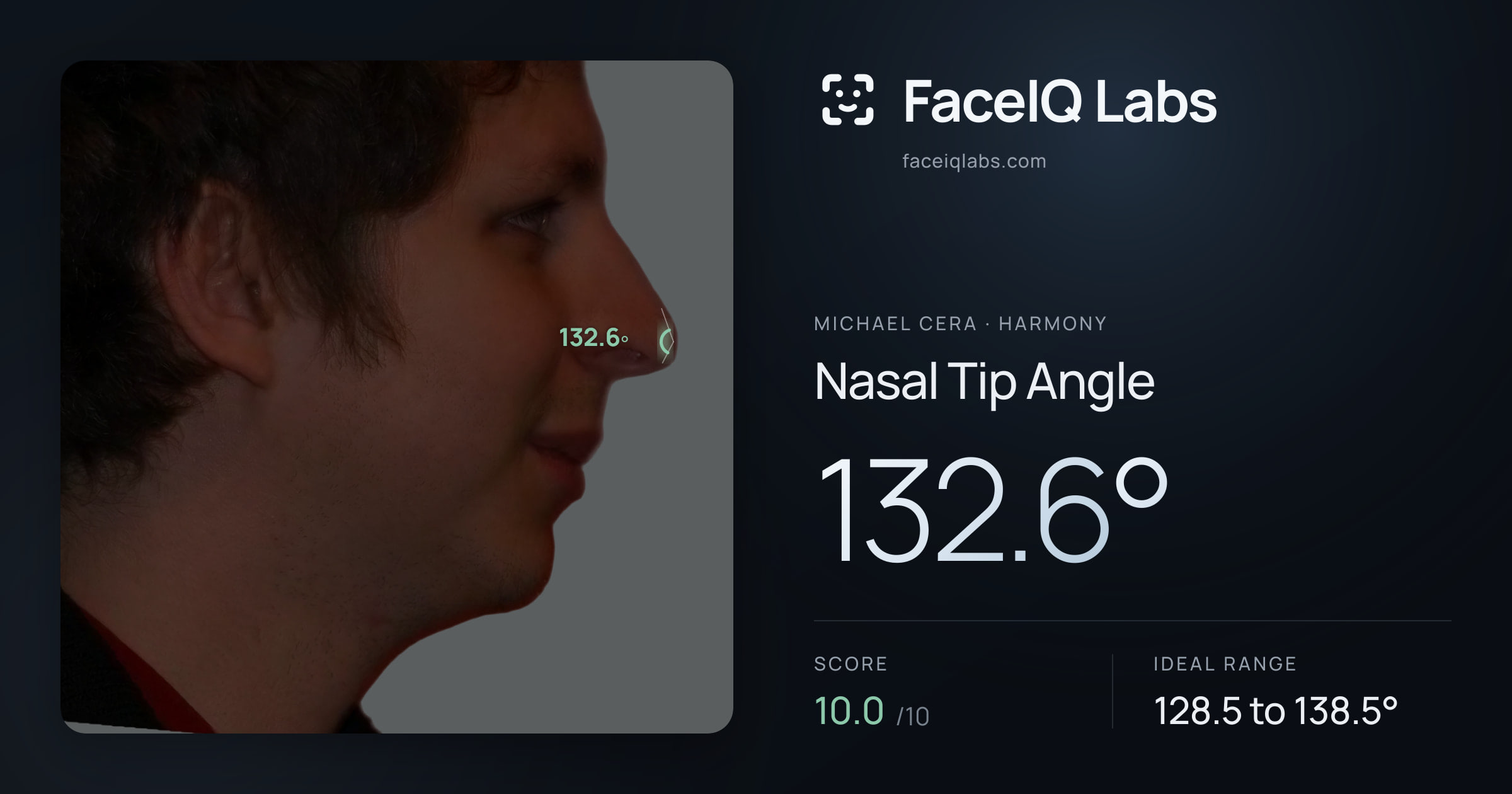 Michael Cera Nasal Tip Angle: 132.6°, drawn on the photo