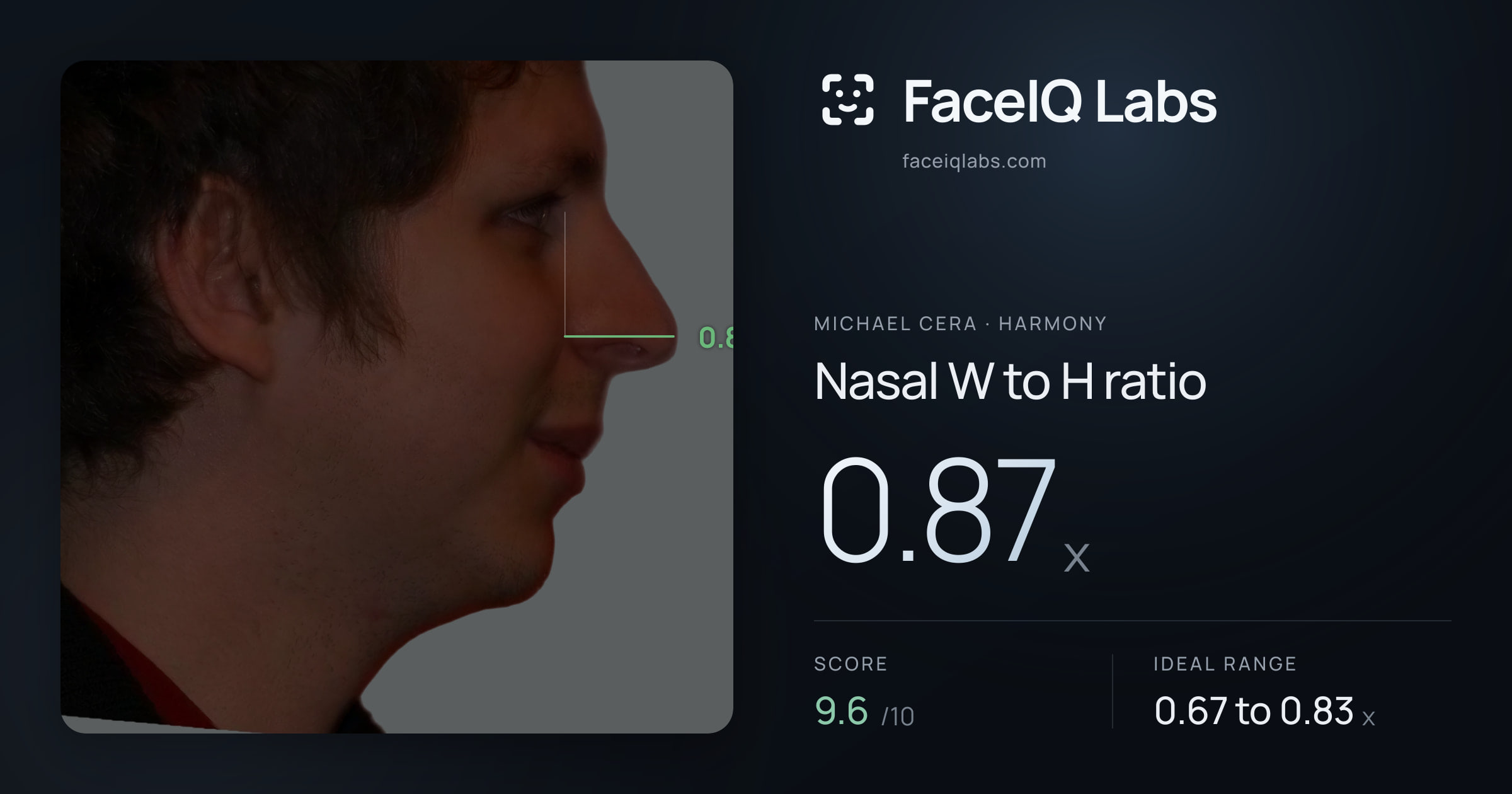 Michael Cera Nasal W to H ratio: 0.87x, drawn on the photo