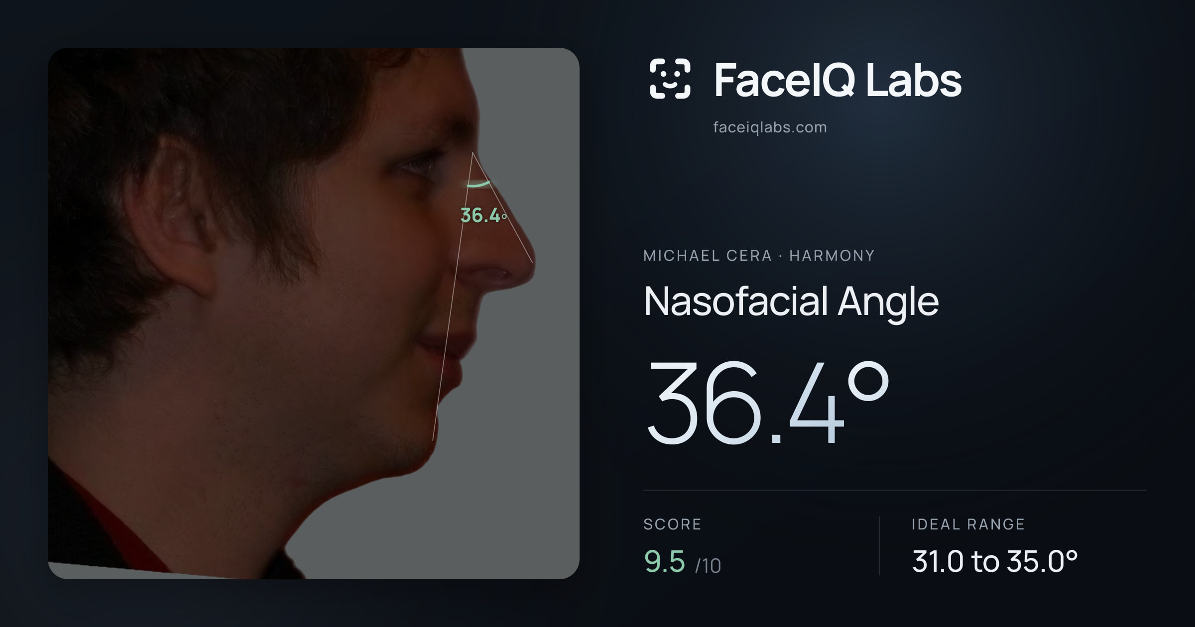 Michael Cera Nasofacial Angle: 36.4°, drawn on the photo