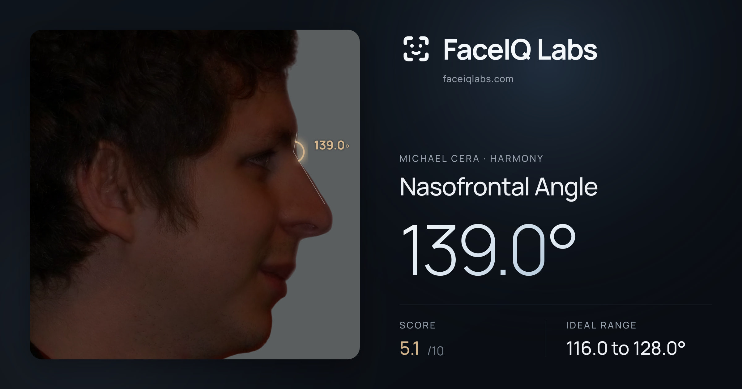 Michael Cera Nasofrontal Angle: 139.0°, drawn on the photo