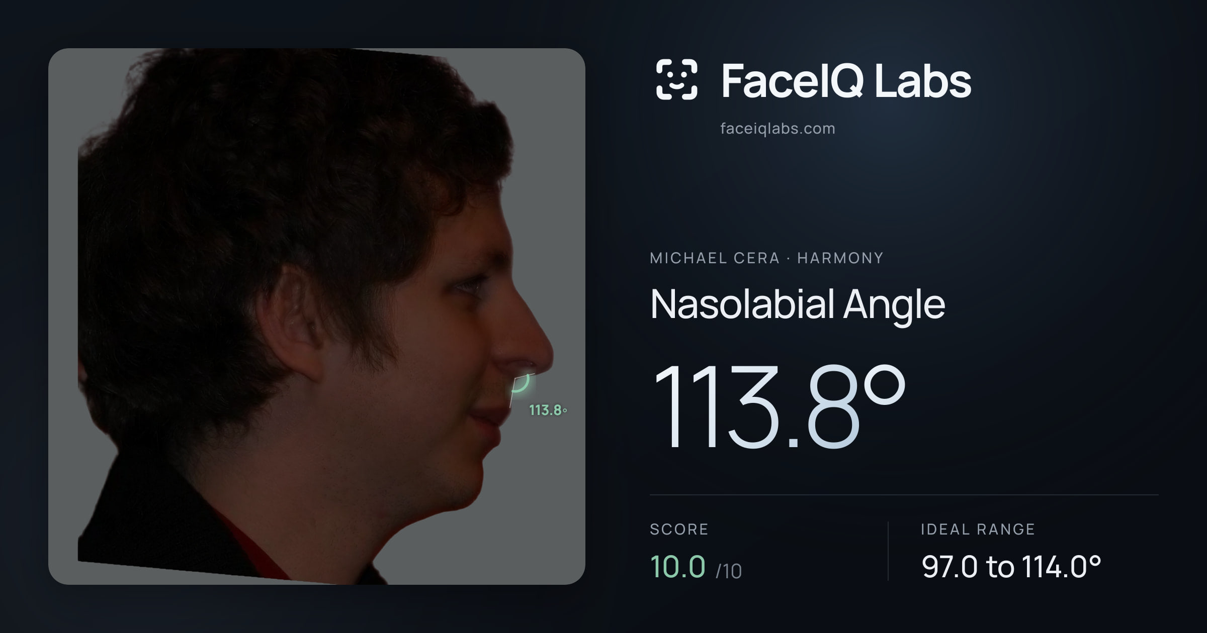 Michael Cera Nasolabial Angle: 113.8°, drawn on the photo