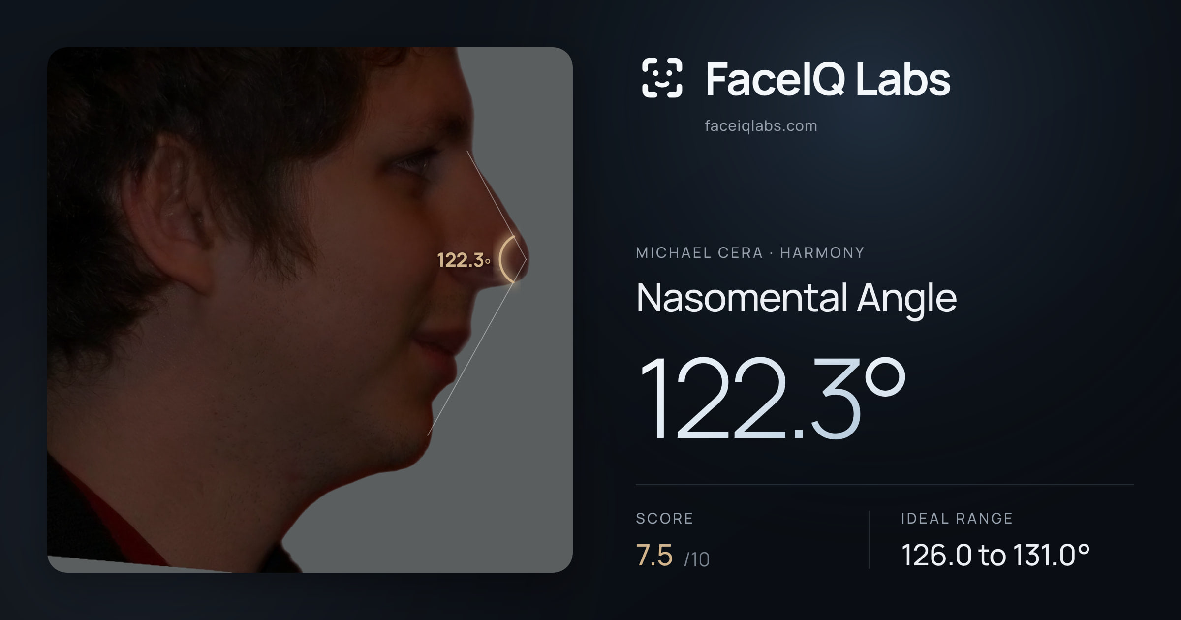 Michael Cera Nasomental Angle: 122.3°, drawn on the photo