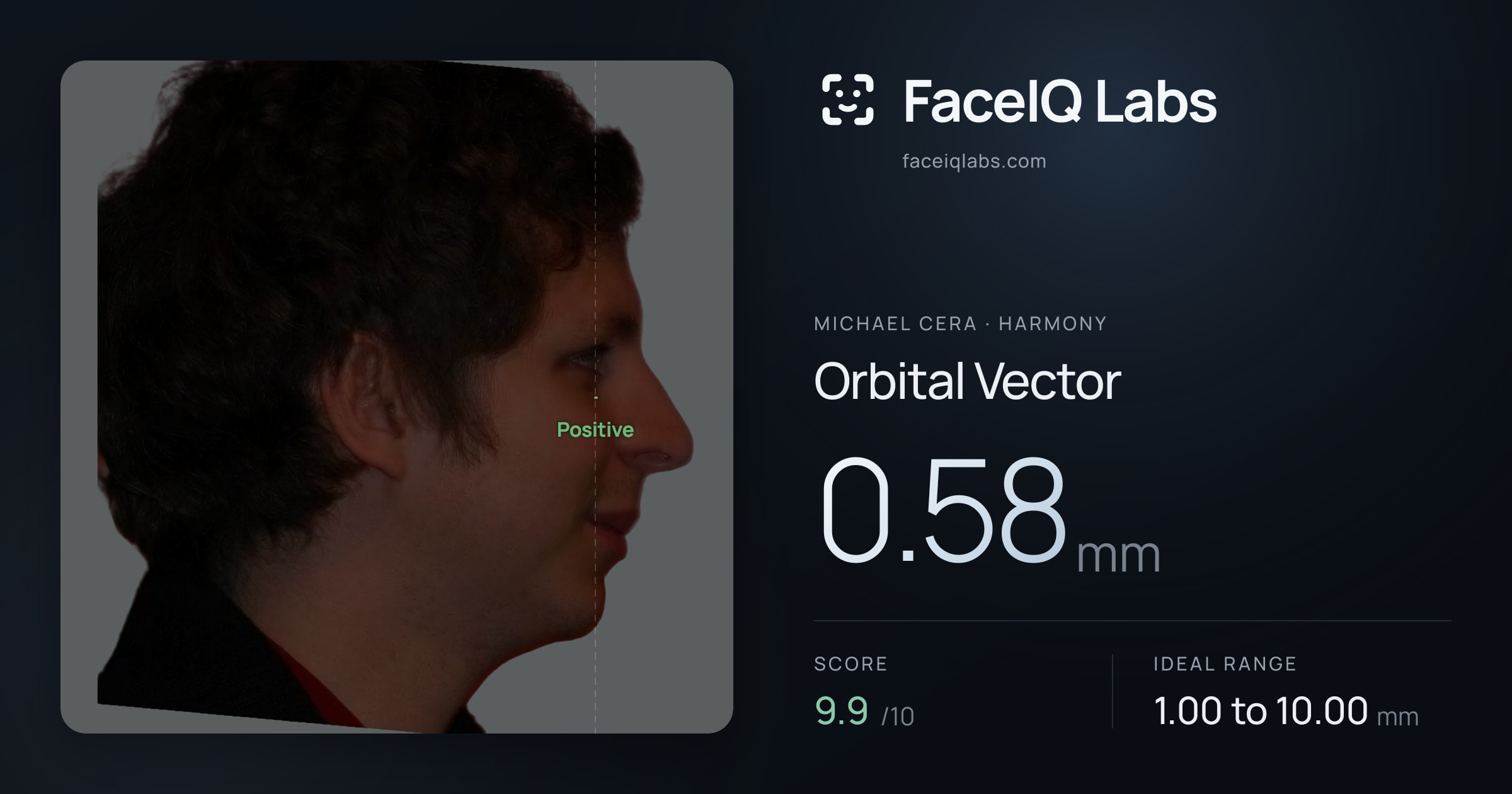 Michael Cera Orbital Vector: 0.58mm, drawn on the photo