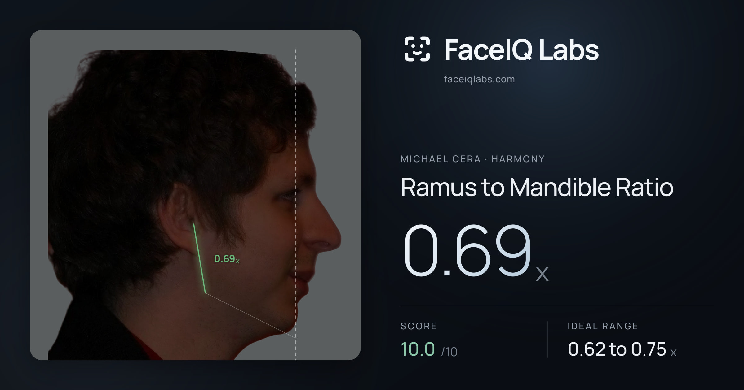 Michael Cera Ramus to Mandible Ratio: 0.69x, drawn on the photo