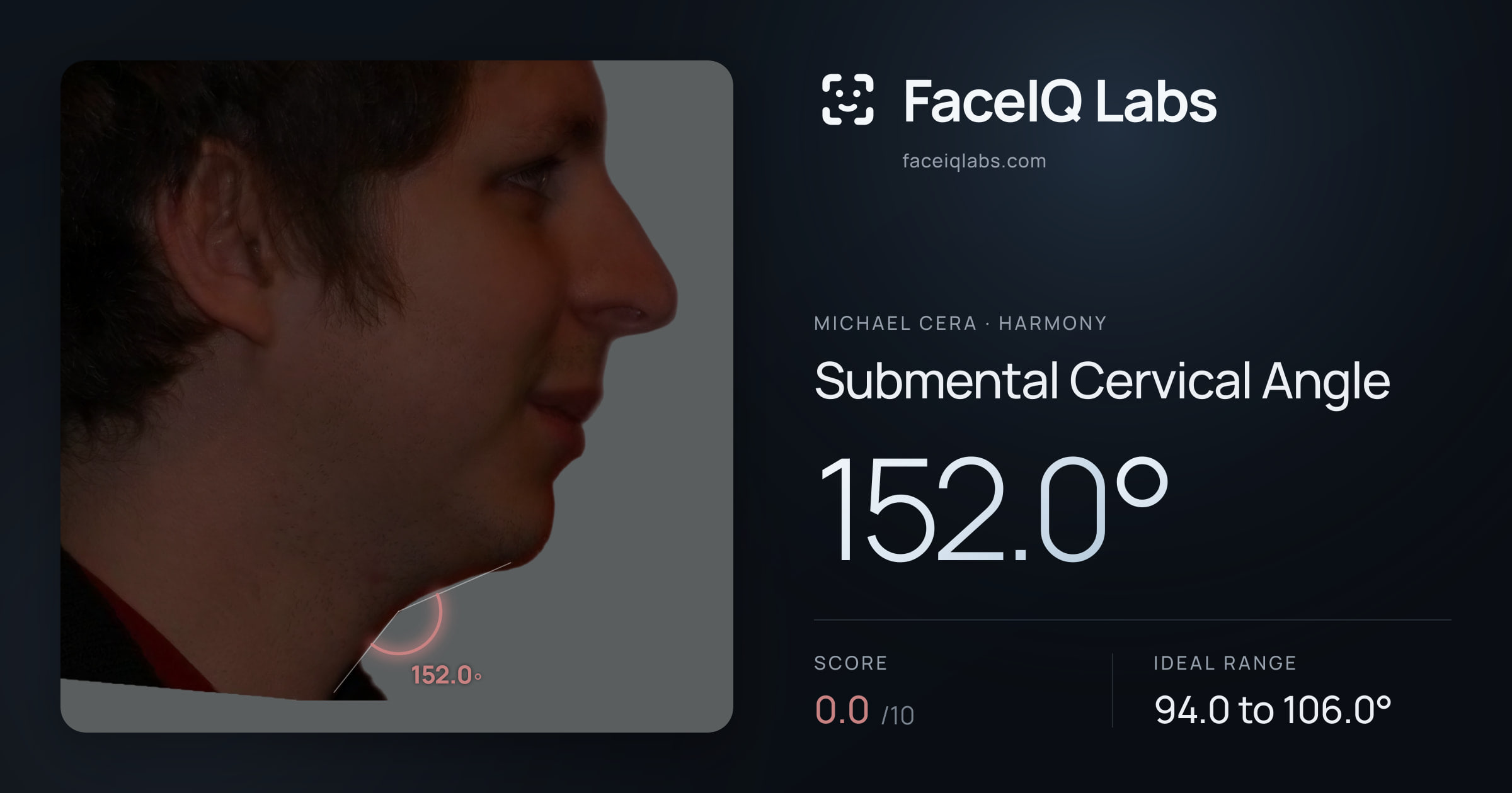 Michael Cera Submental Cervical Angle: 152.0°, drawn on the photo