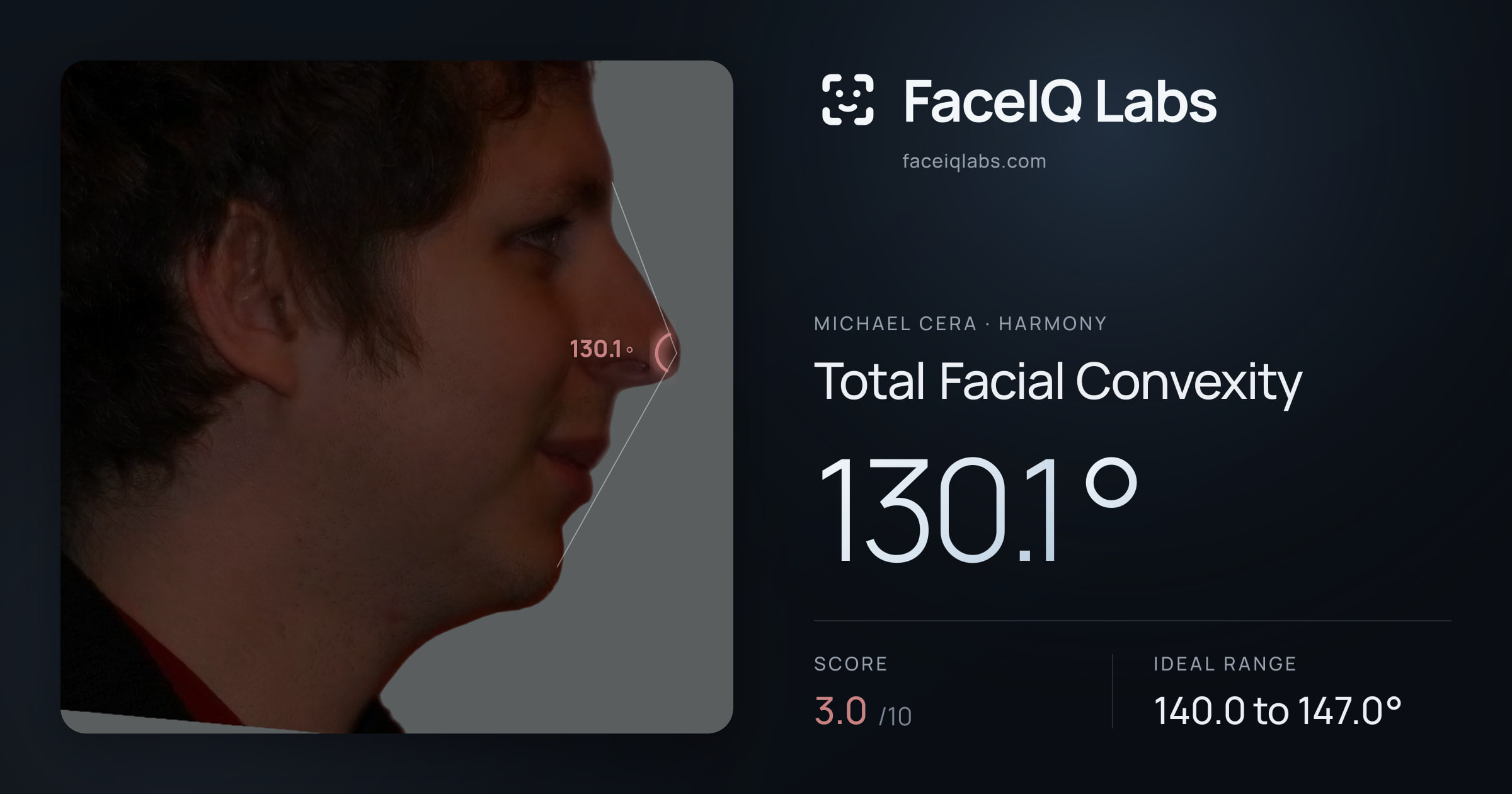 Michael Cera Total Facial Convexity: 130.1°, drawn on the photo