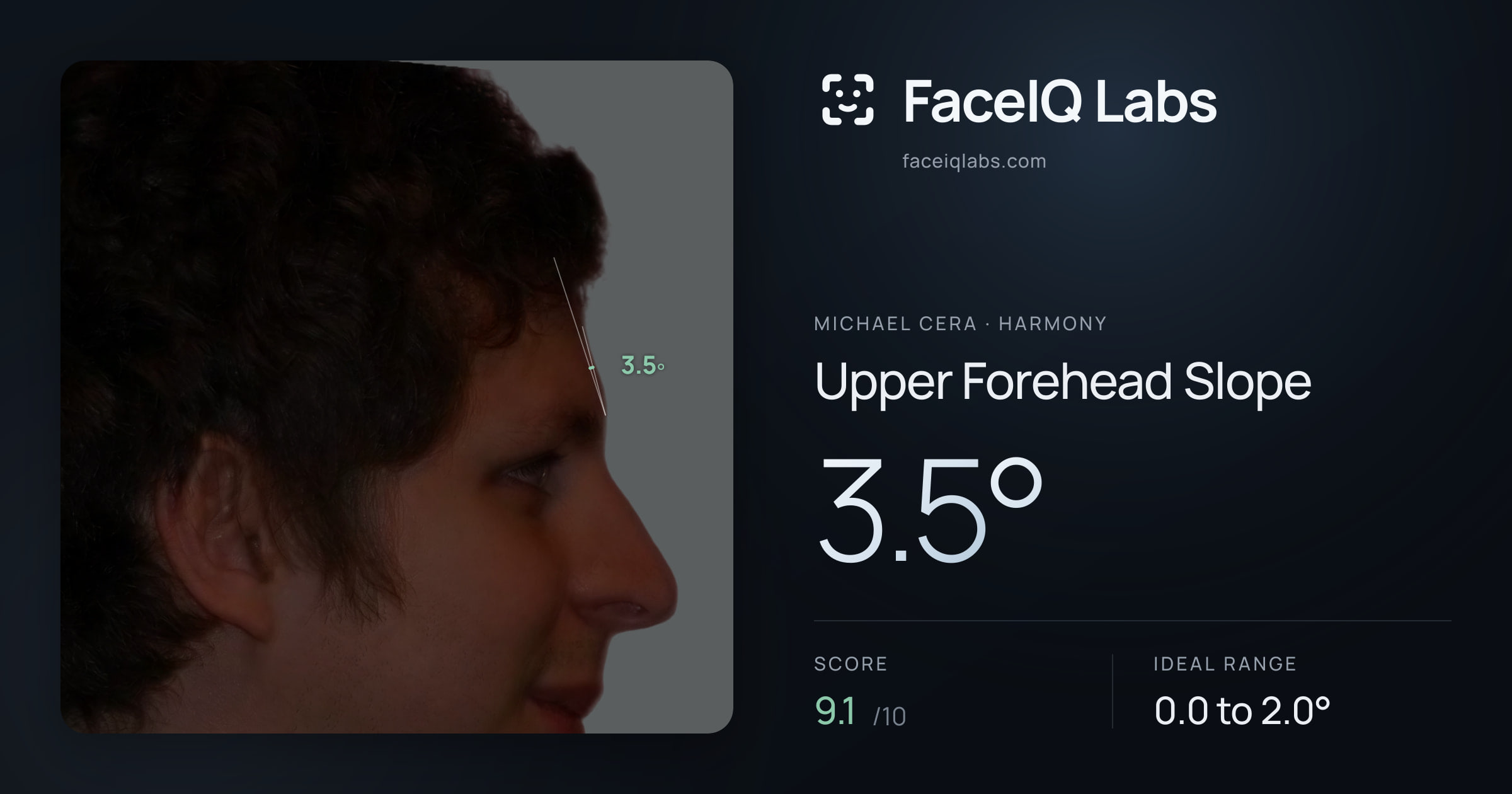 Michael Cera Upper Forehead Slope: 3.5°, drawn on the photo