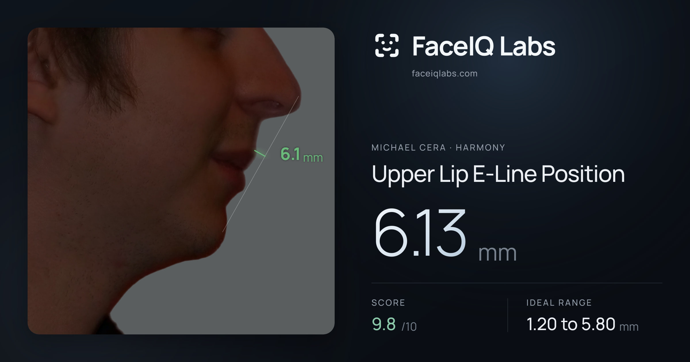 Michael Cera Upper Lip E-Line Position: 6.13mm, drawn on the photo