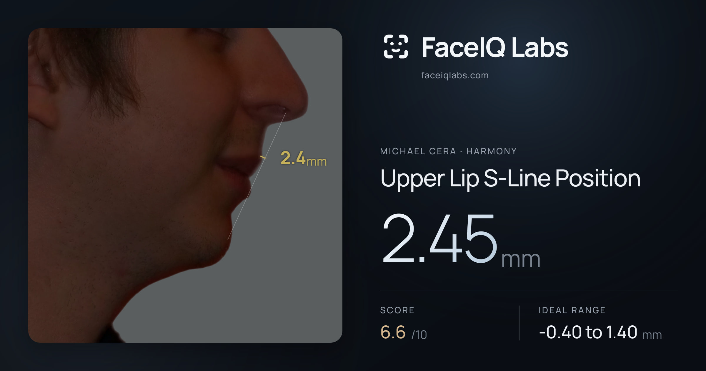 Michael Cera Upper Lip S-Line Position: 2.45mm, drawn on the photo