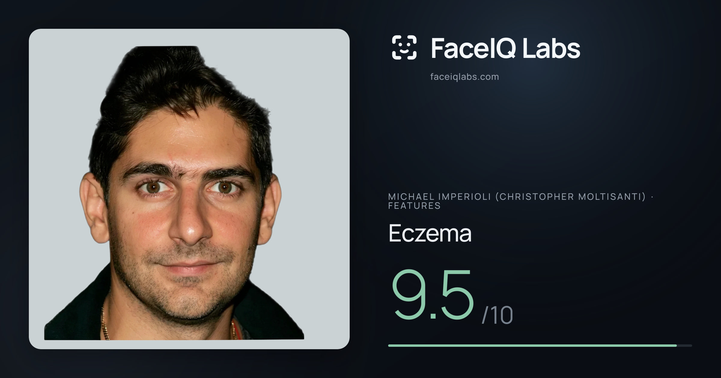 Michael Imperioli (Christopher Moltisanti) Eczema: 9.5/10, drawn on the photo