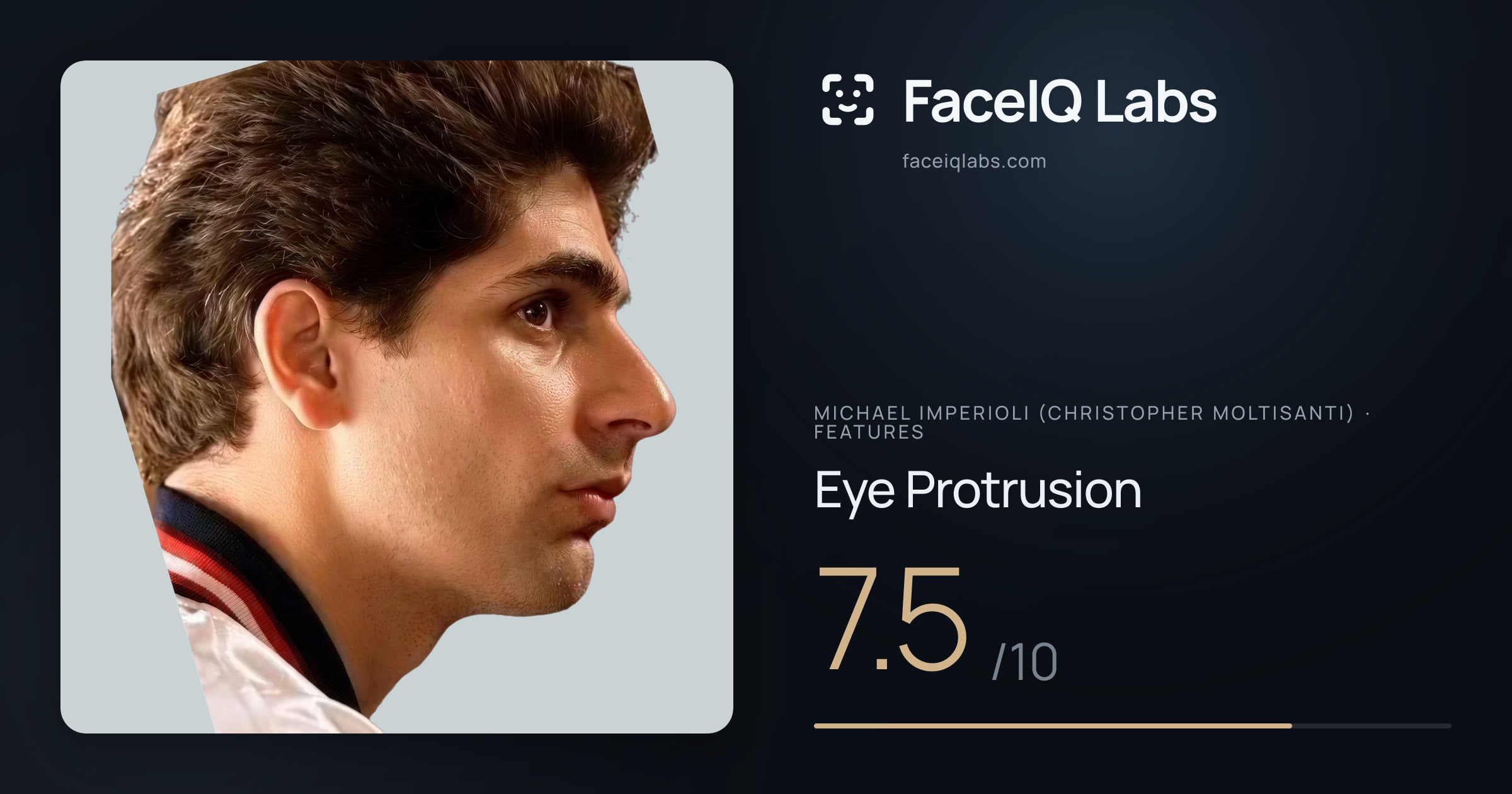 Michael Imperioli (Christopher Moltisanti) Eye Protrusion: 7.5/10, drawn on the photo