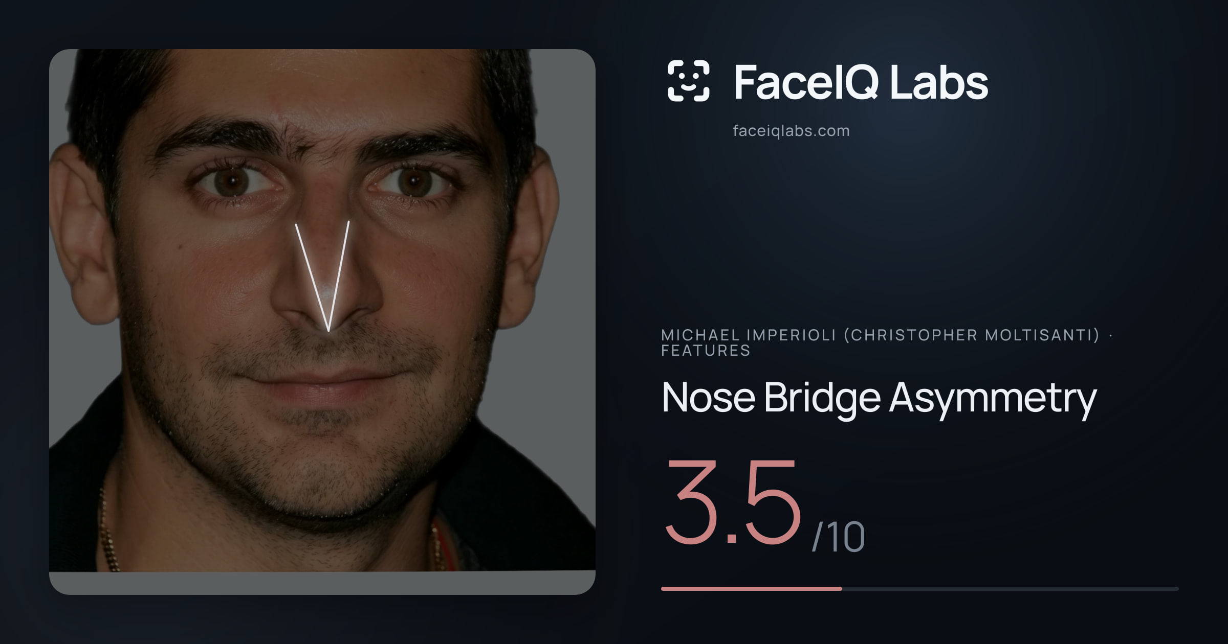 Michael Imperioli (Christopher Moltisanti) Nose Bridge Asymmetry: 3.5/10, drawn on the photo