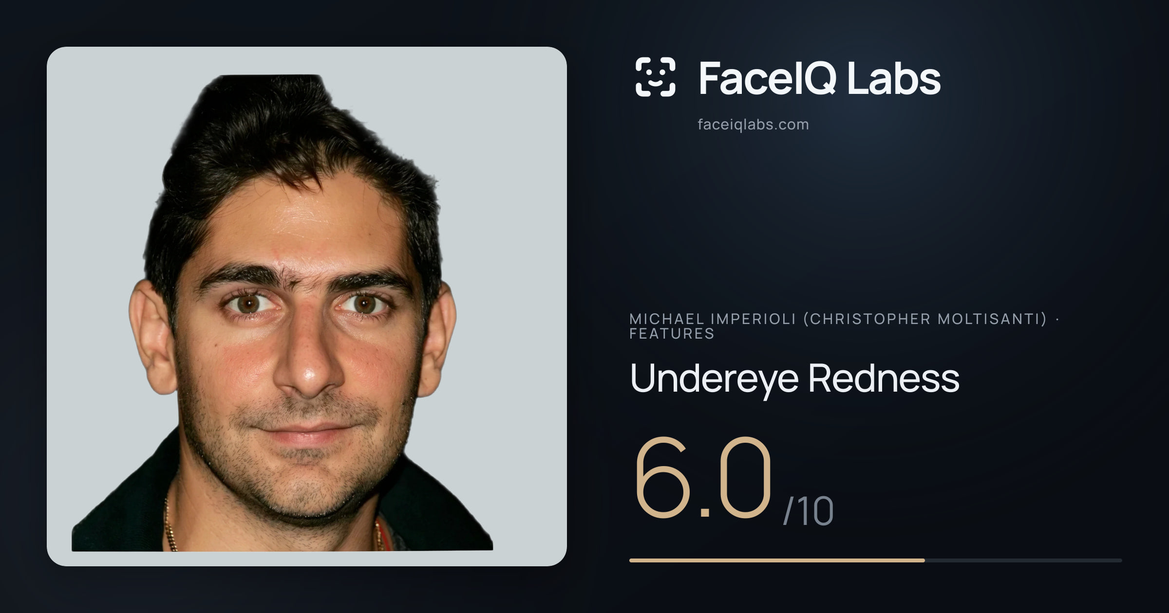 Michael Imperioli (Christopher Moltisanti) Undereye Redness: 6.0/10, drawn on the photo