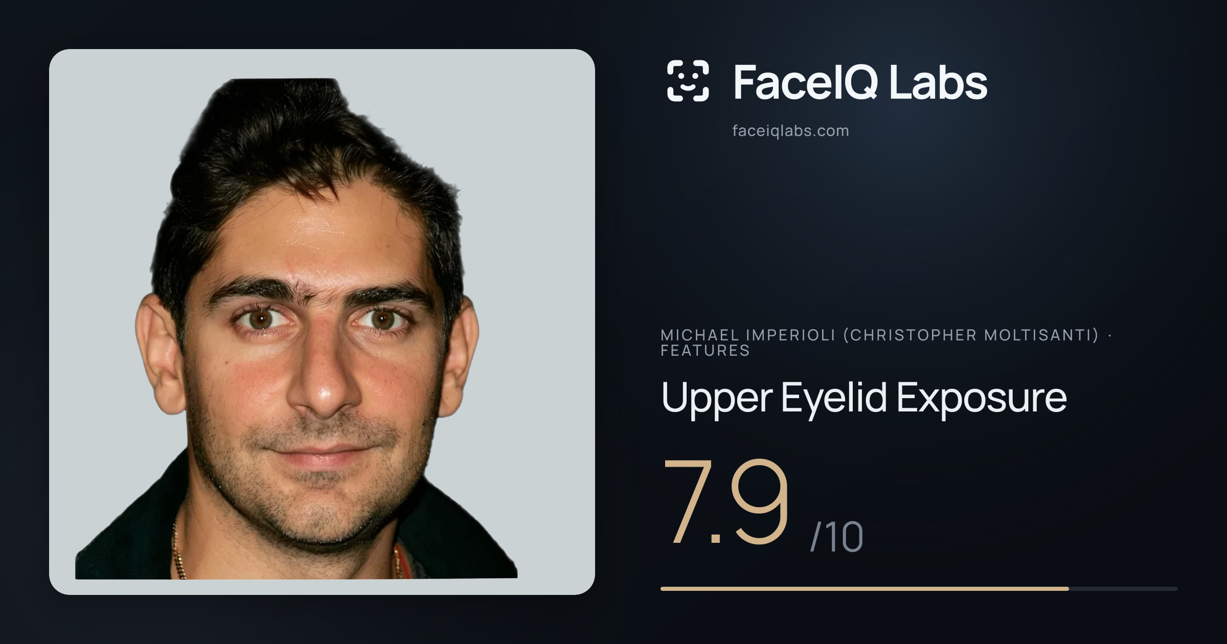 Michael Imperioli (Christopher Moltisanti) Upper Eyelid Exposure: 4.5/10, drawn on the photo