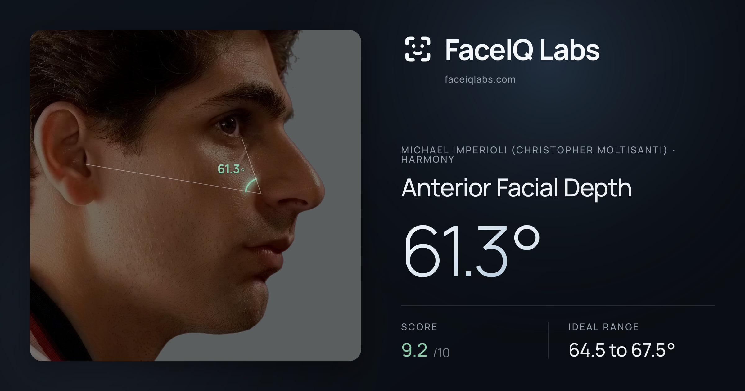 Michael Imperioli (Christopher Moltisanti) Anterior Facial Depth: 61.3°, drawn on the photo